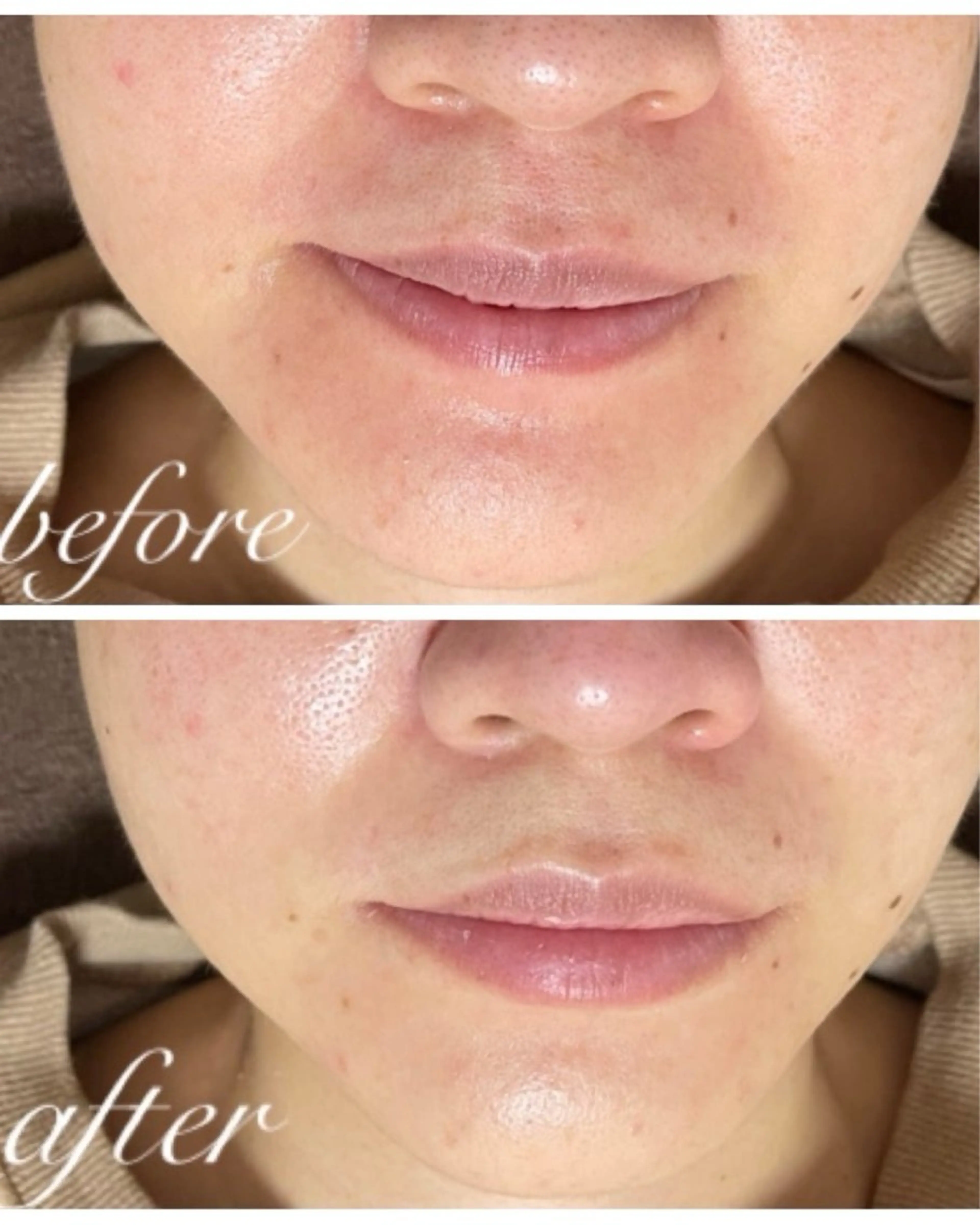 エステルーム ラティア所属・今井 登美子のエステ・リラクイメージ