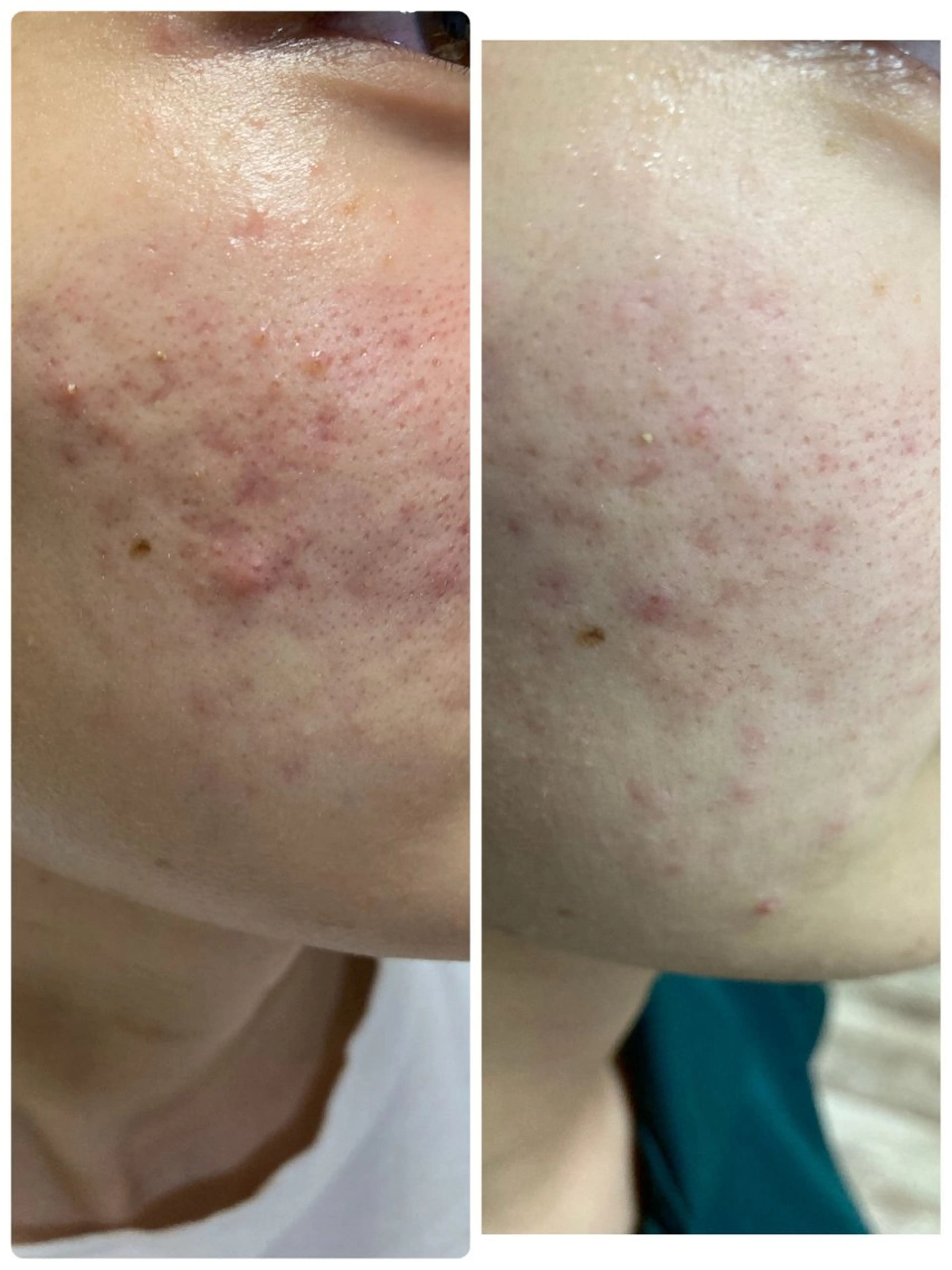 シミシワタルミ改善 美肌サロン松本浩美のエステ・リラクイメージ