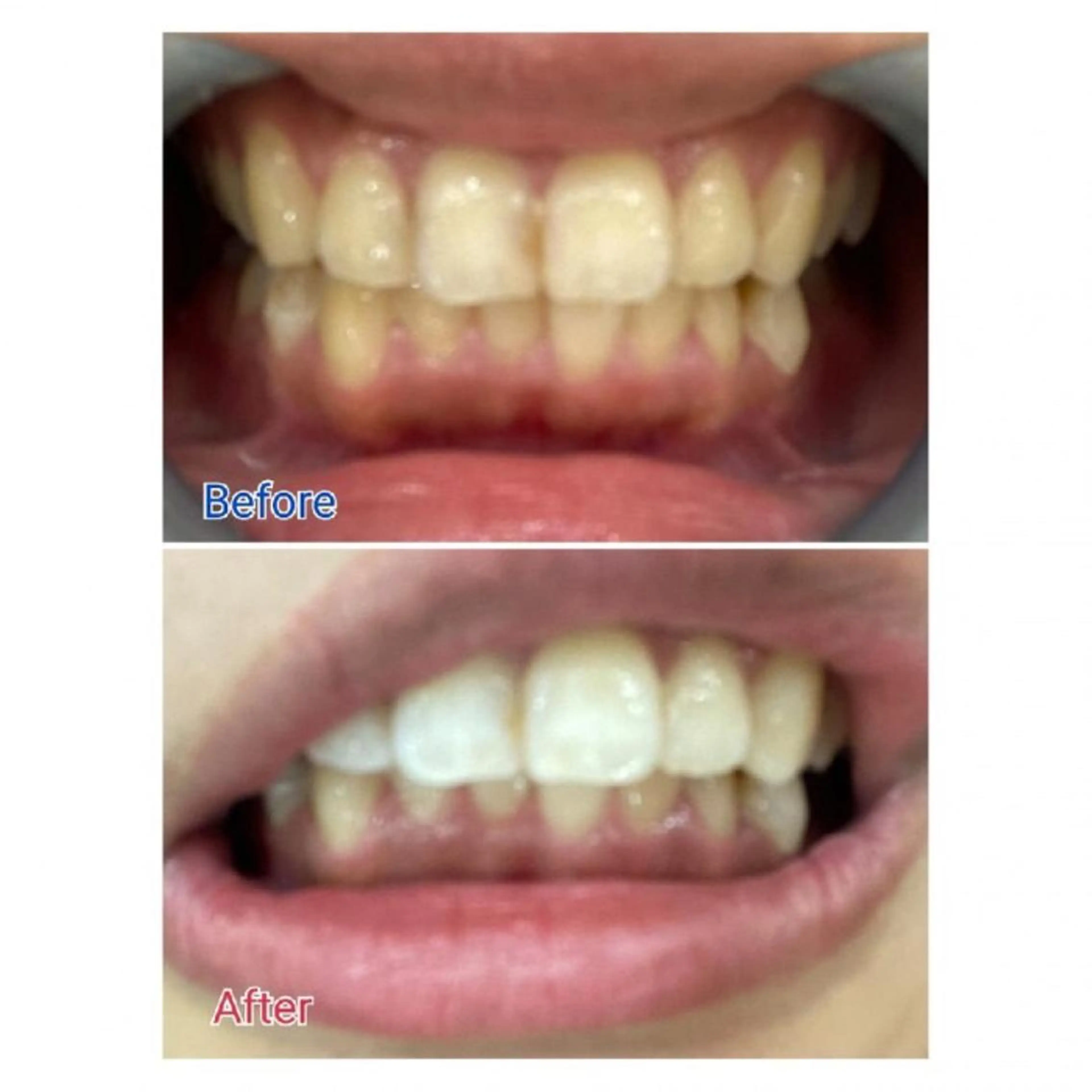 M渋谷店所属・M渋谷 ホワイトニングのエステ・リラクイメージ