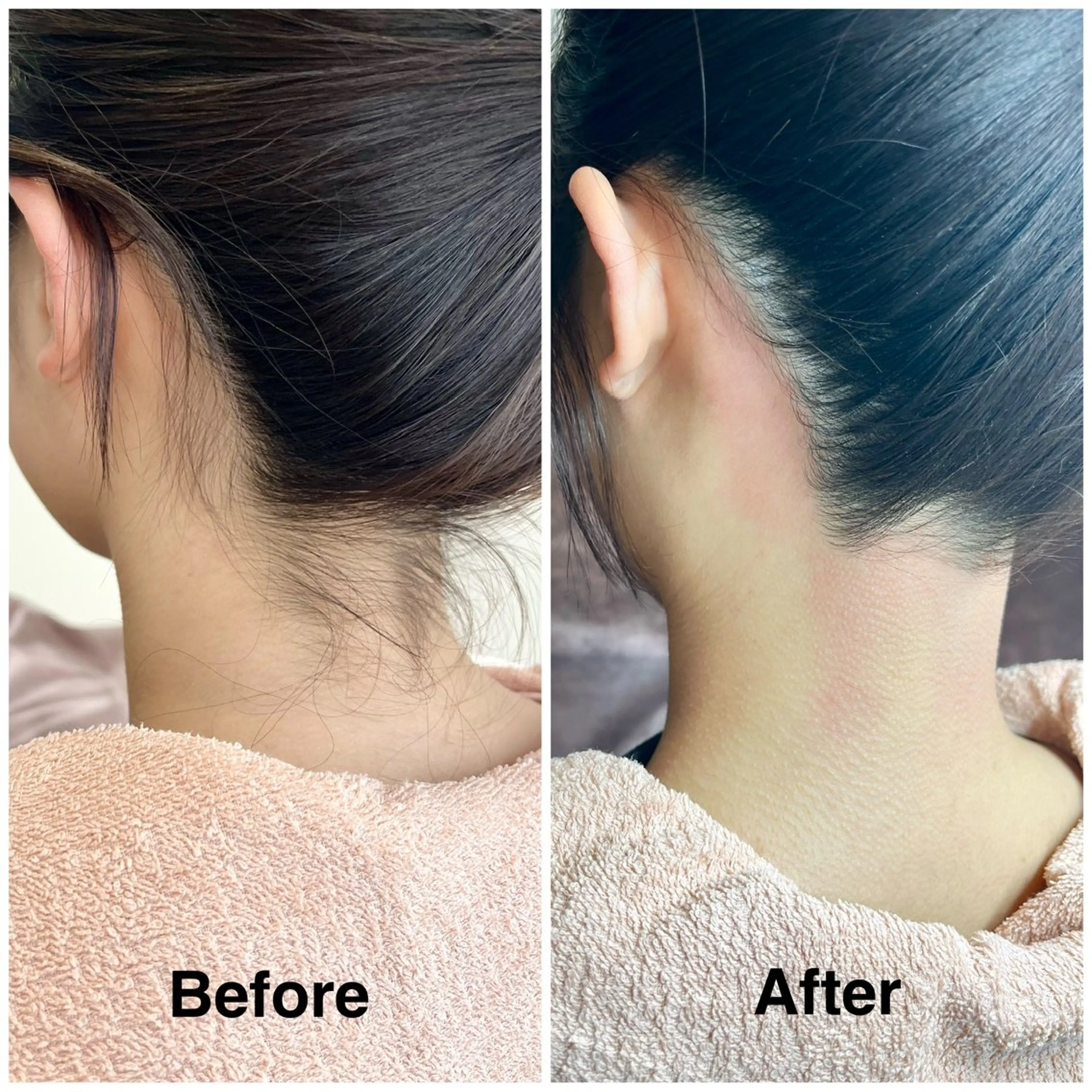 脱毛 高見 明子のエステ・リラクイメージ