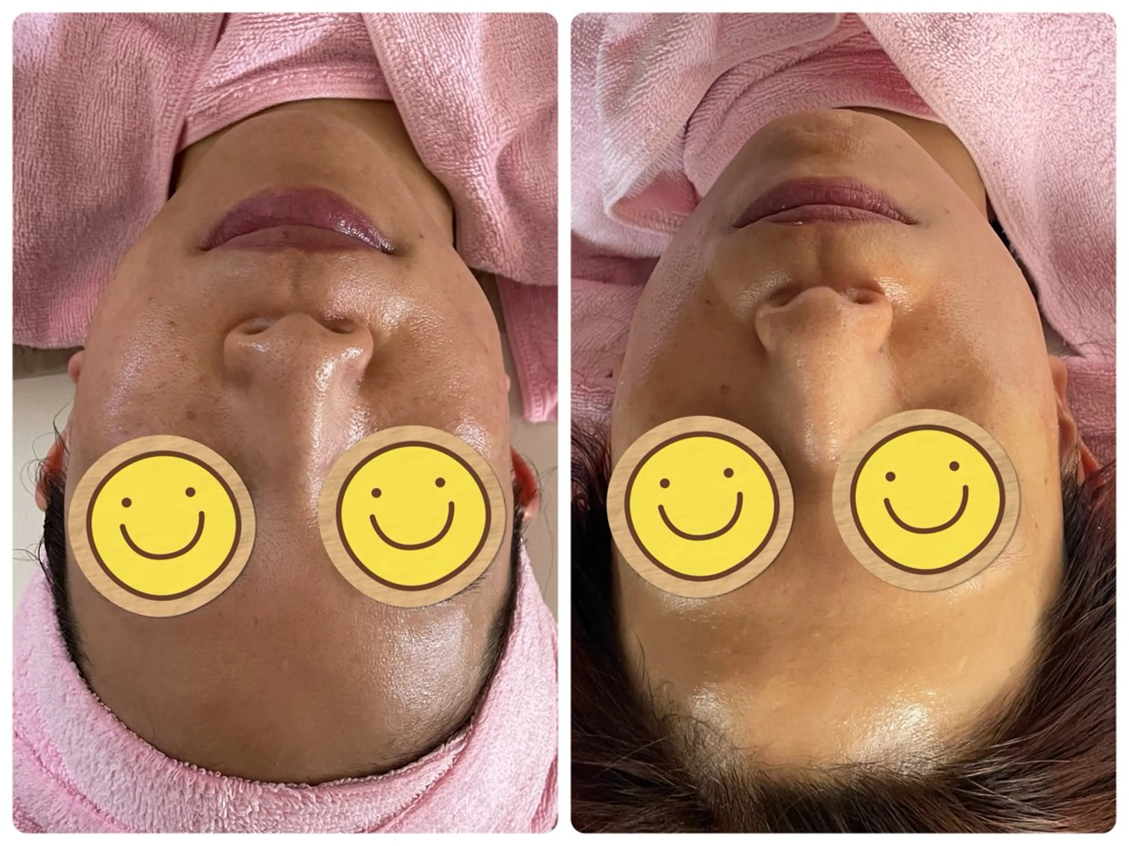 Salon Rion所属・Rion 野々村のエステ・リラクイメージ