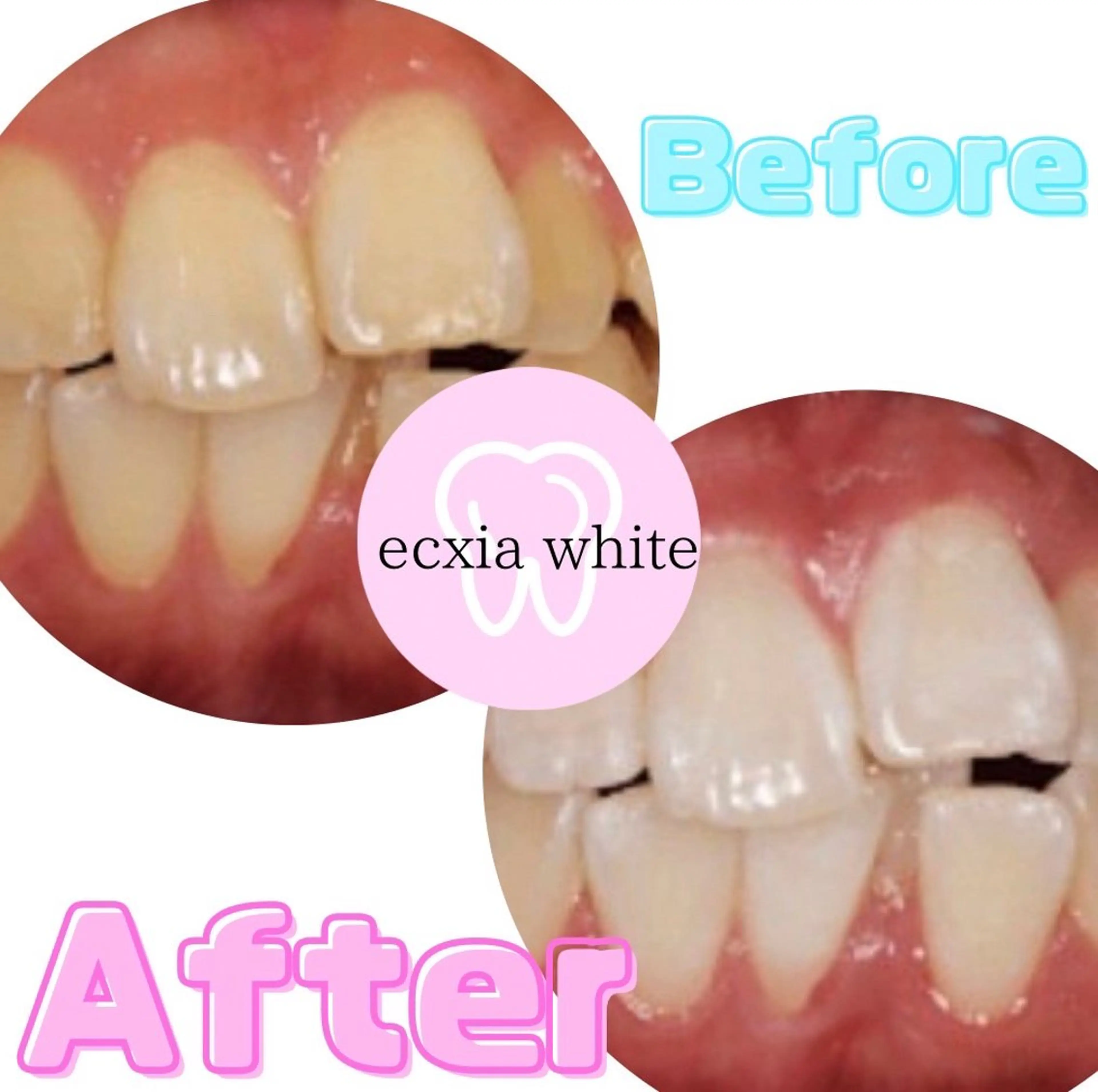 セルフホワイトニング　エクシア 町田店所属・セルフホワイトニング エクシア町田店のその他イメージ