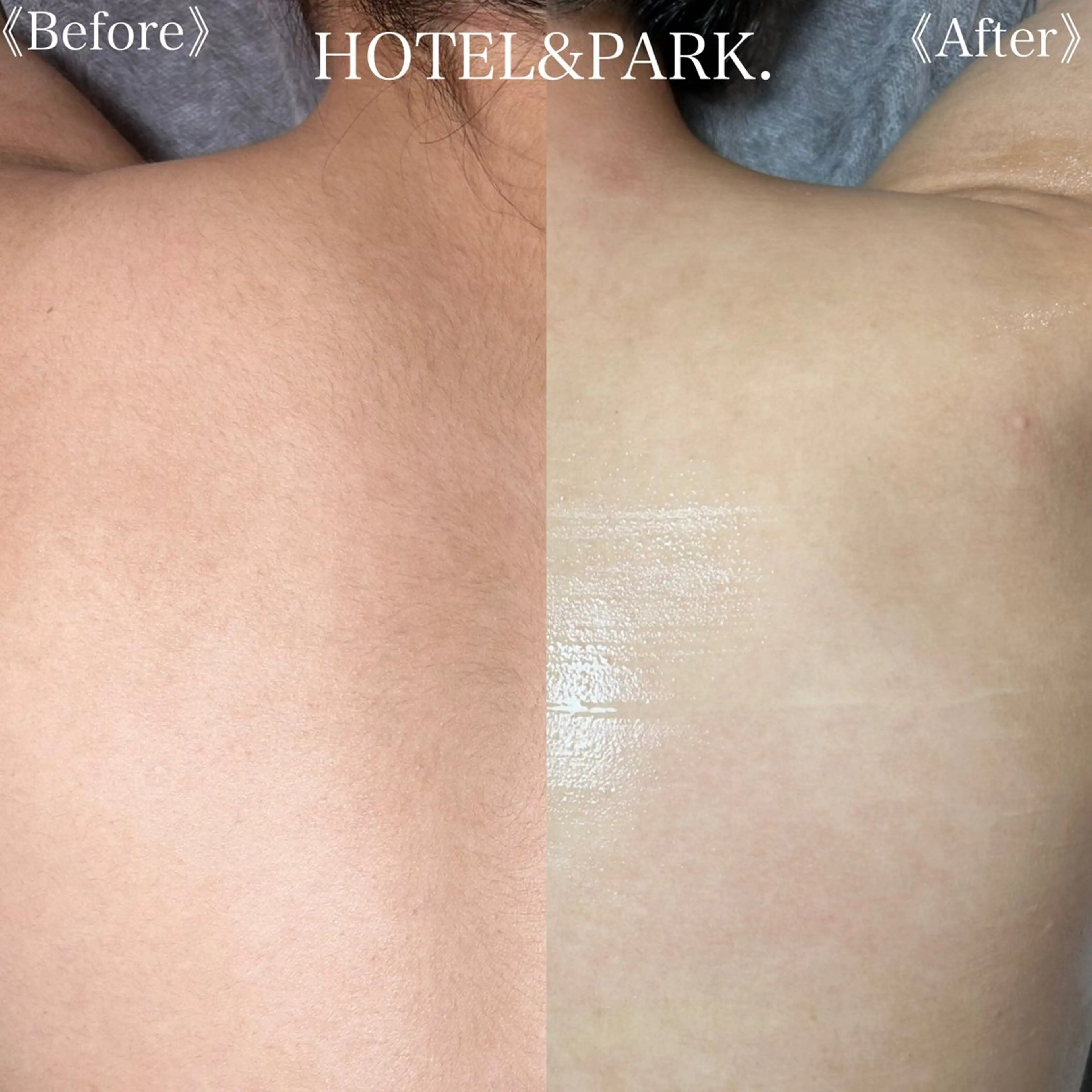 HOTEL&PARK .Moeワックス脱毛のエステ・リラクイメージ