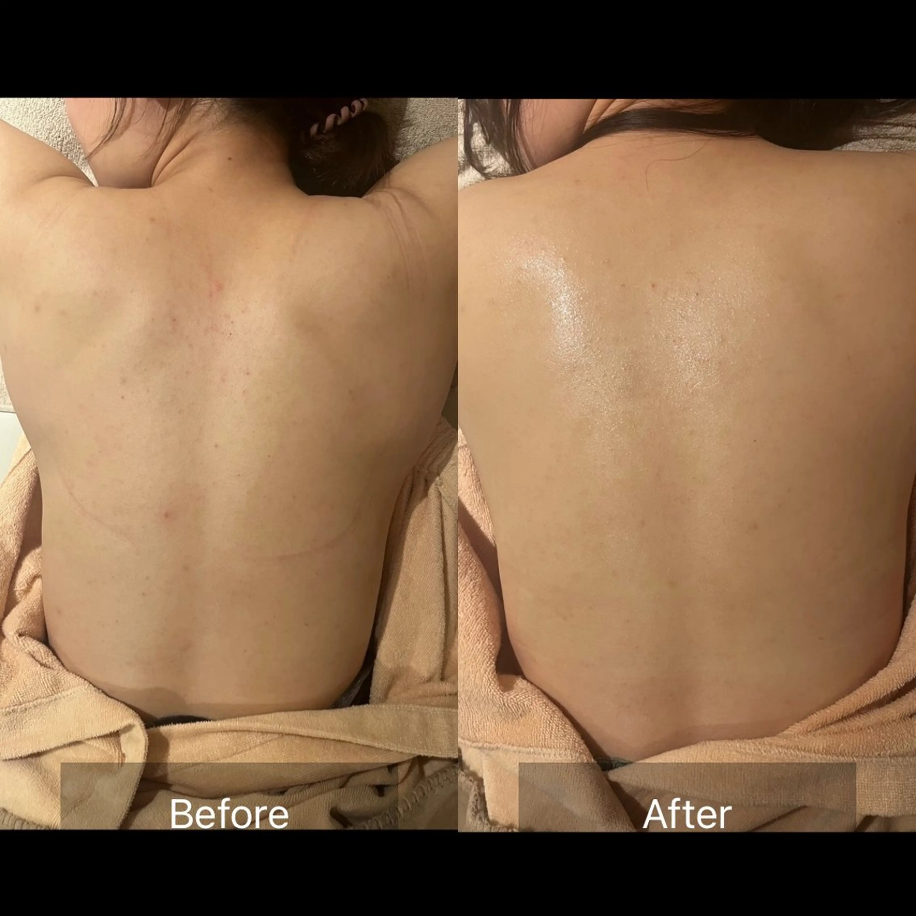 その他 for woman所属・森 美優のエステ・リラクイメージ