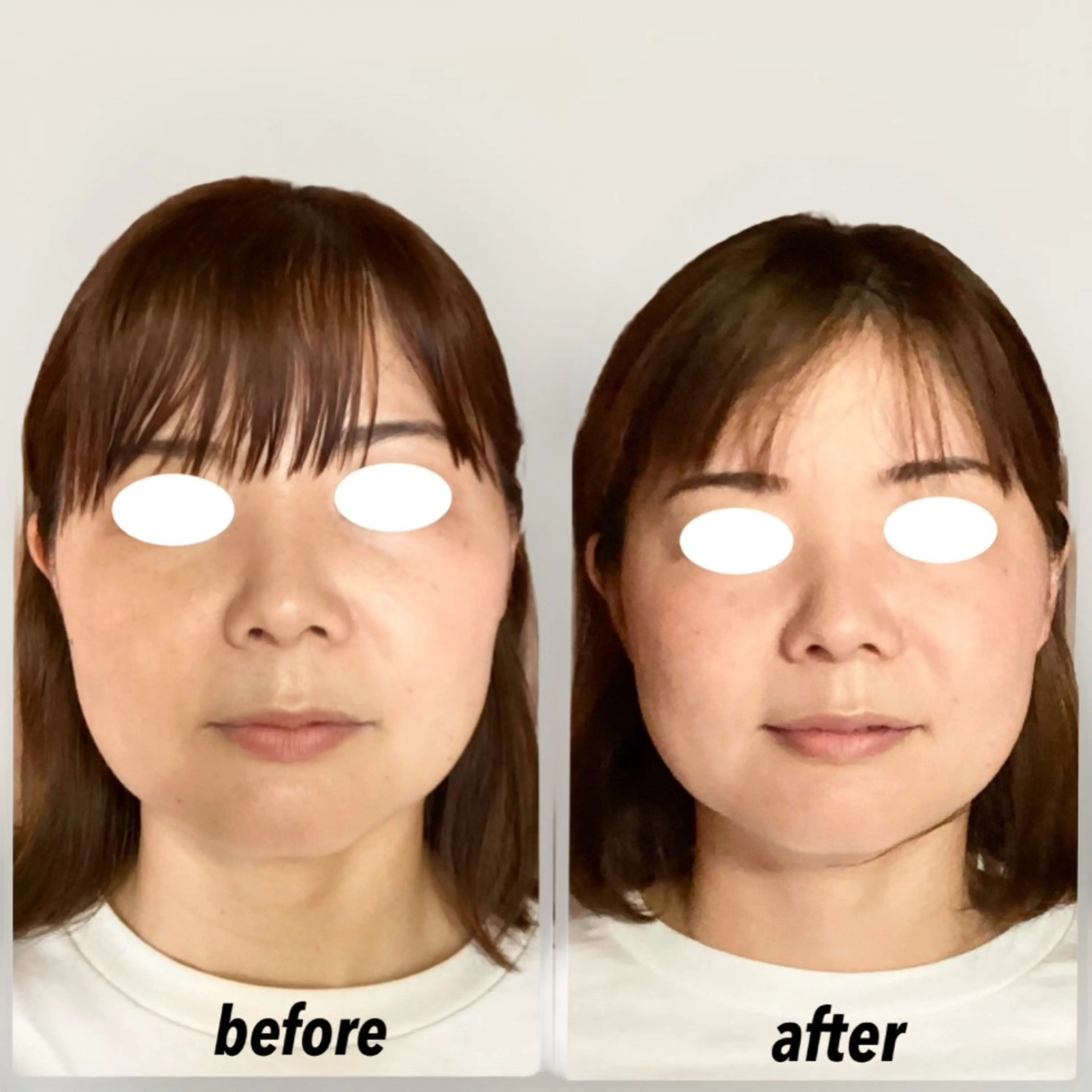 エステ リラク ルコナビューティ所属・小顔・歪み専門 井元 朋子のエステ・リラクイメージ