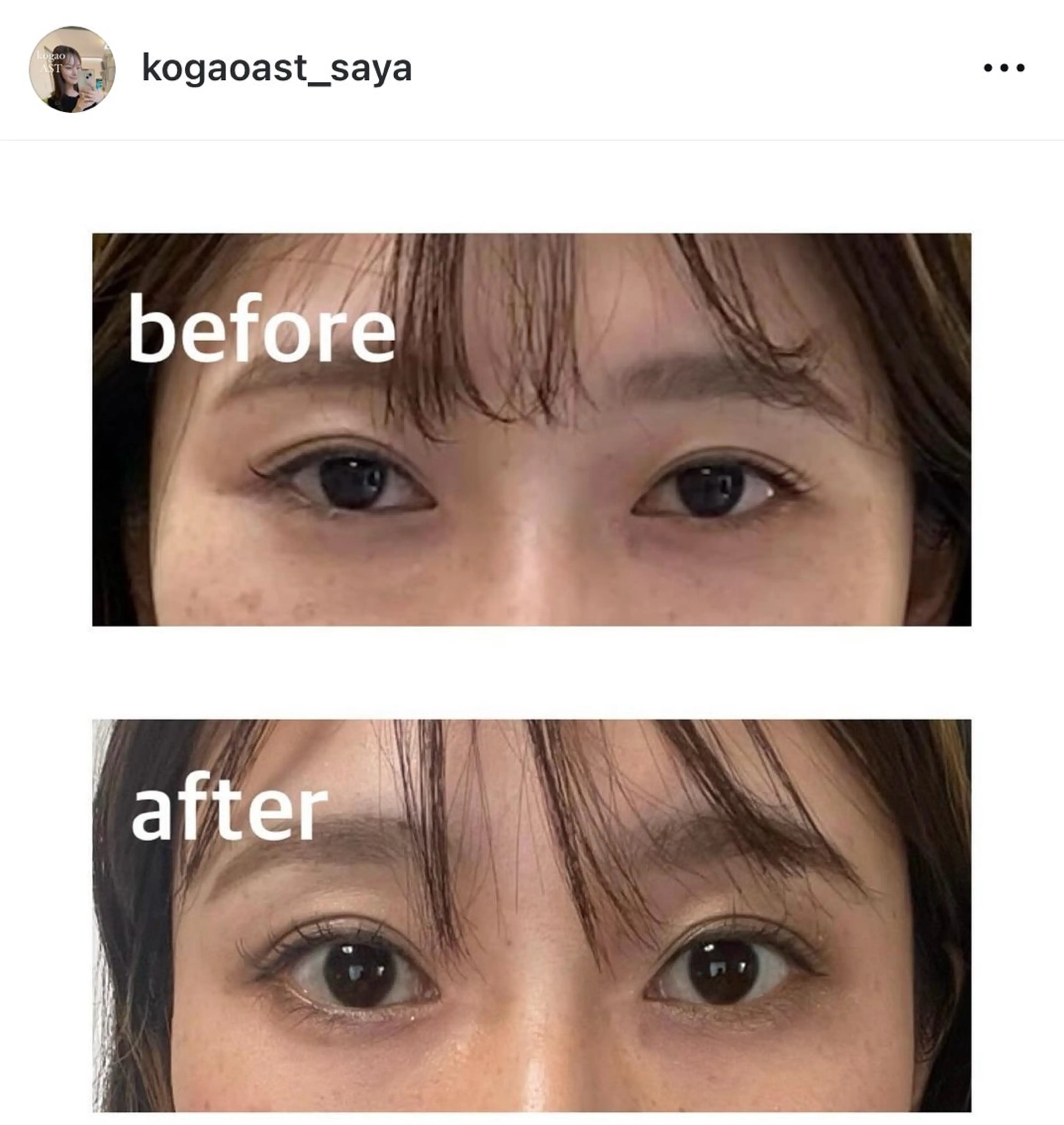 エステ リラク 小顔矯正サロンAST【アスト】所属・小顔矯正サロン AST【アスト】のその他イメージ