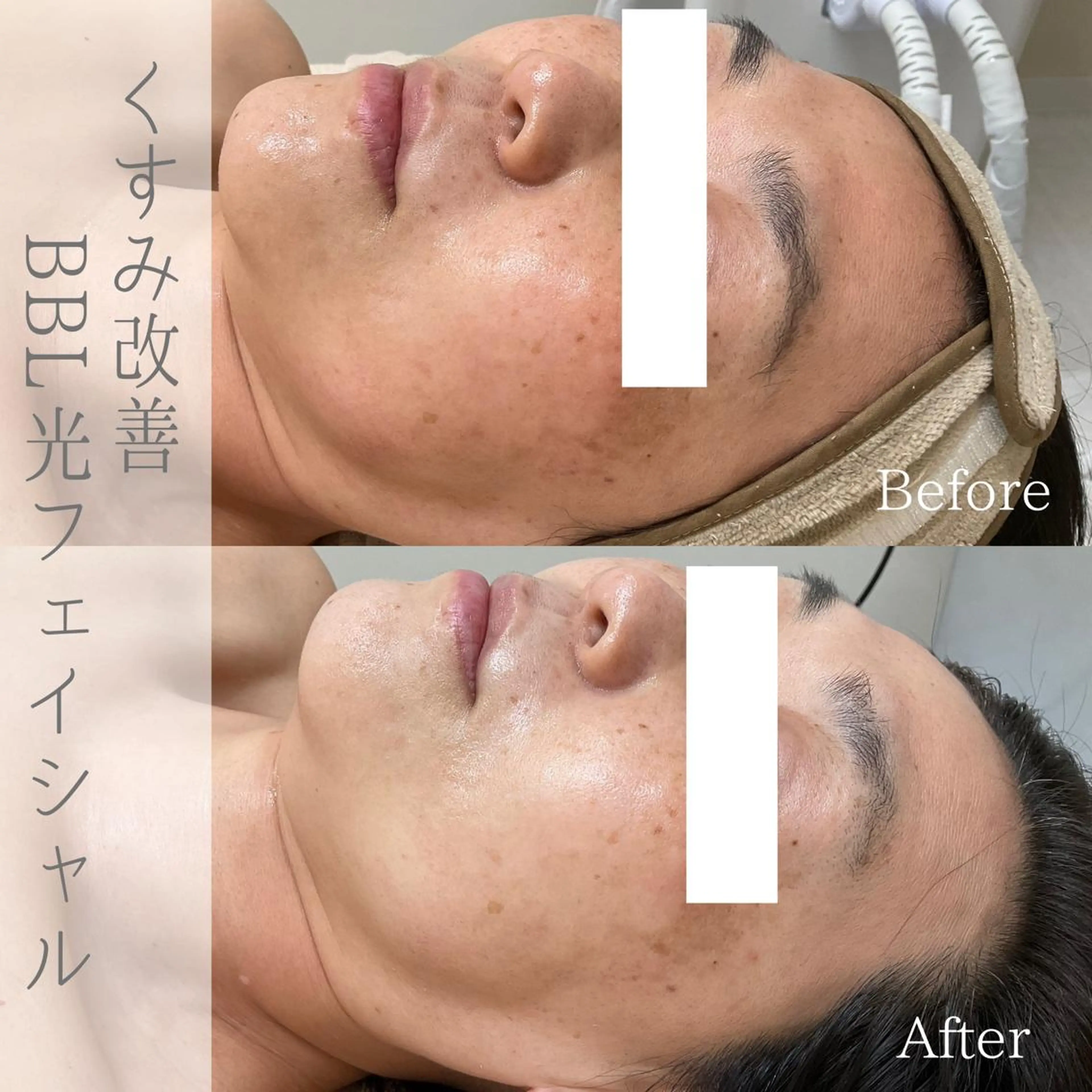 エステ ciena KAYOのその他イメージ