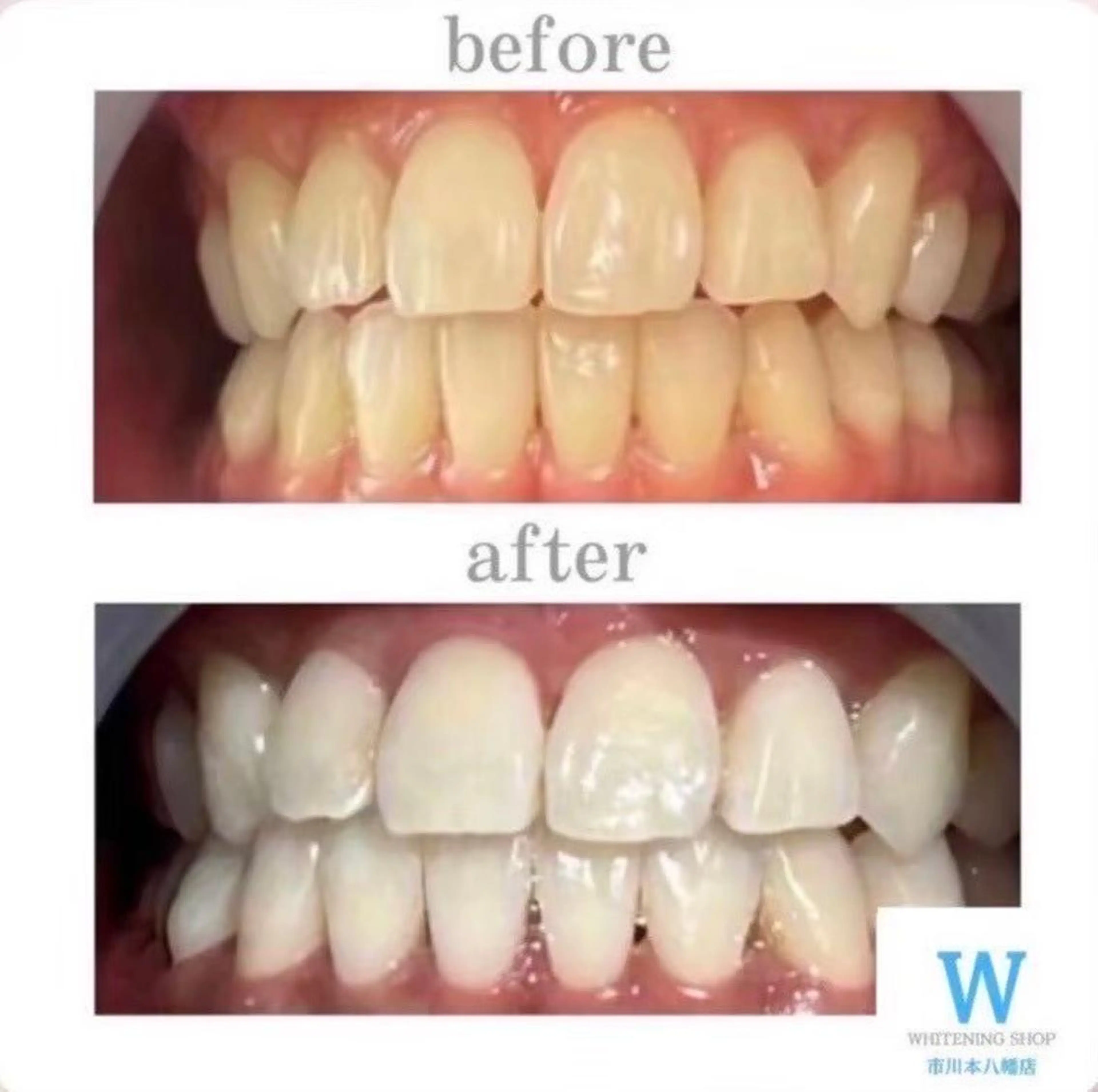 ホワイトニング ショップ本八幡店のエステ・リラクイメージ