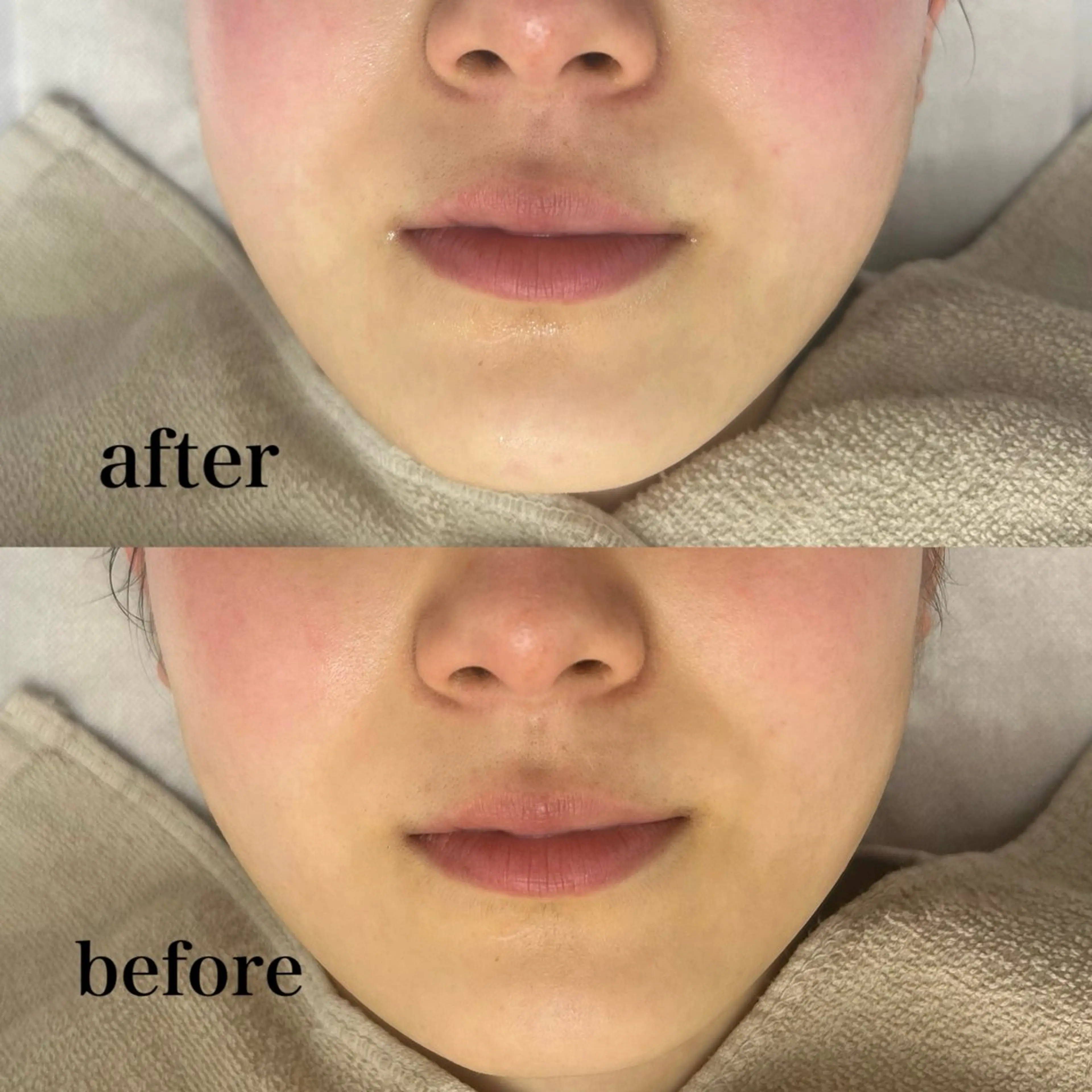 エステ フェイシャルサロン CHIARA 荒田のエステ・リラクイメージ