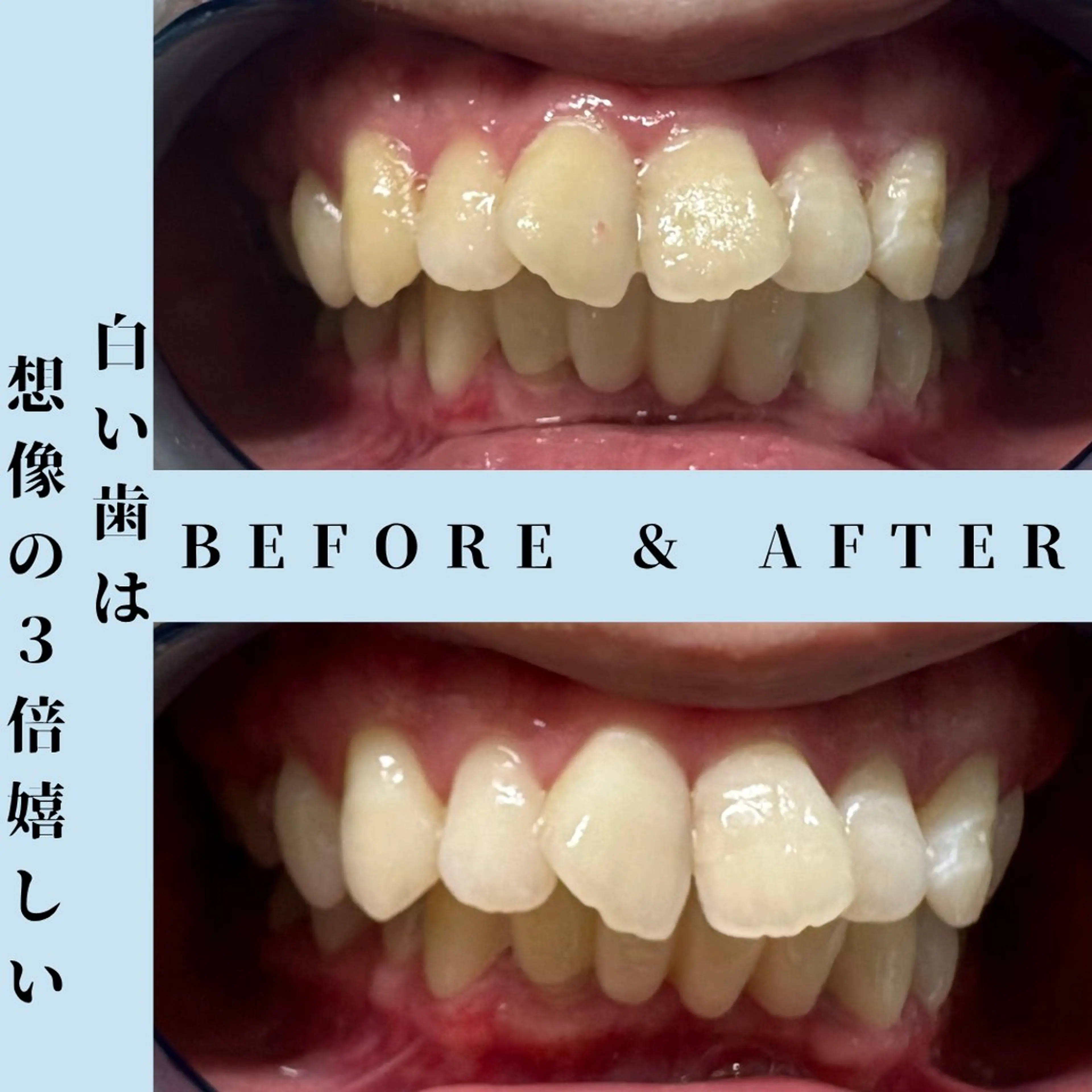 その他 セルフホワイトニング Dolce水戸店のその他イメージ