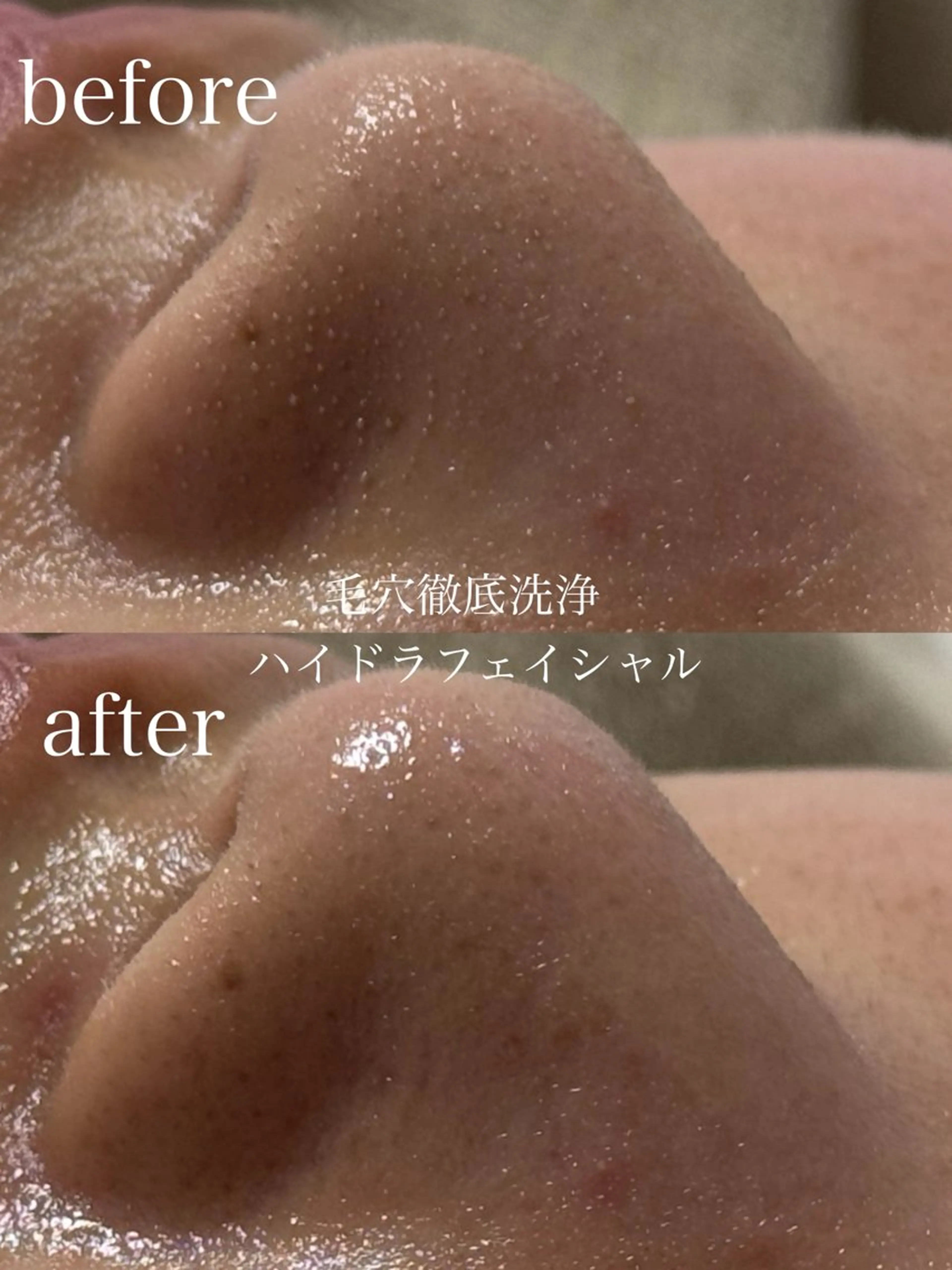 エステ フェイシャルサロン CHIARA鈴木のエステ・リラクイメージ