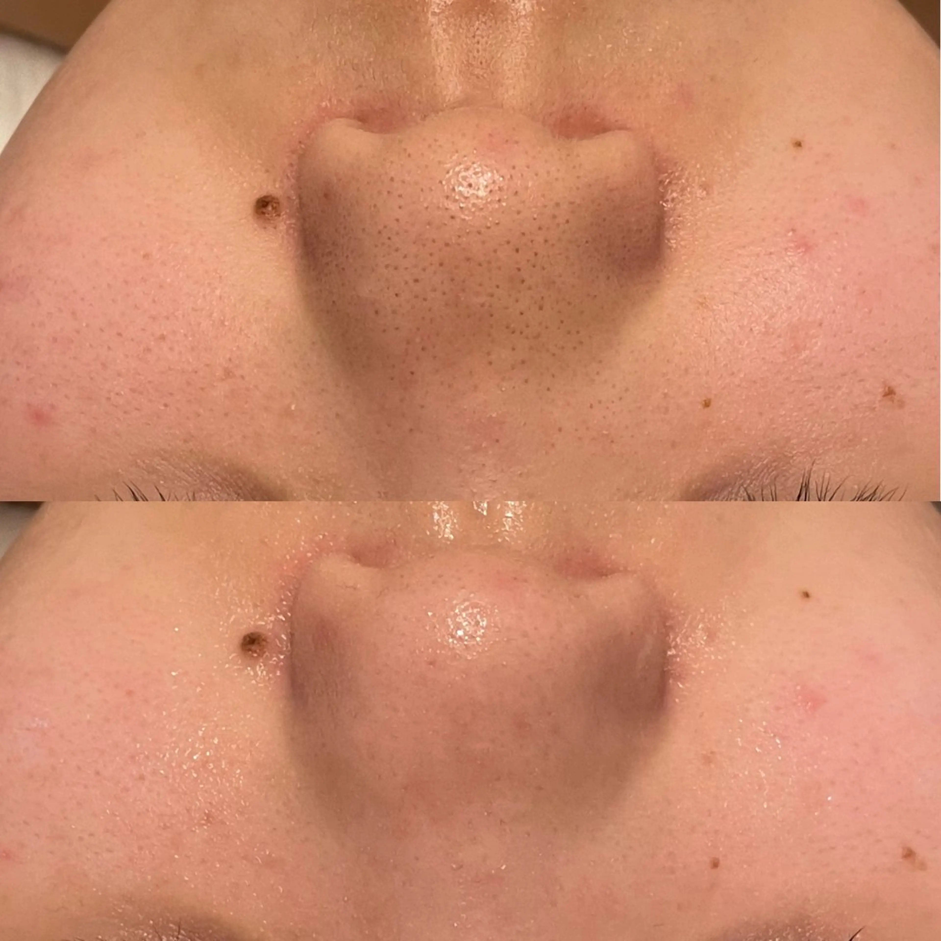 エステ private saloneclatのその他イメージ