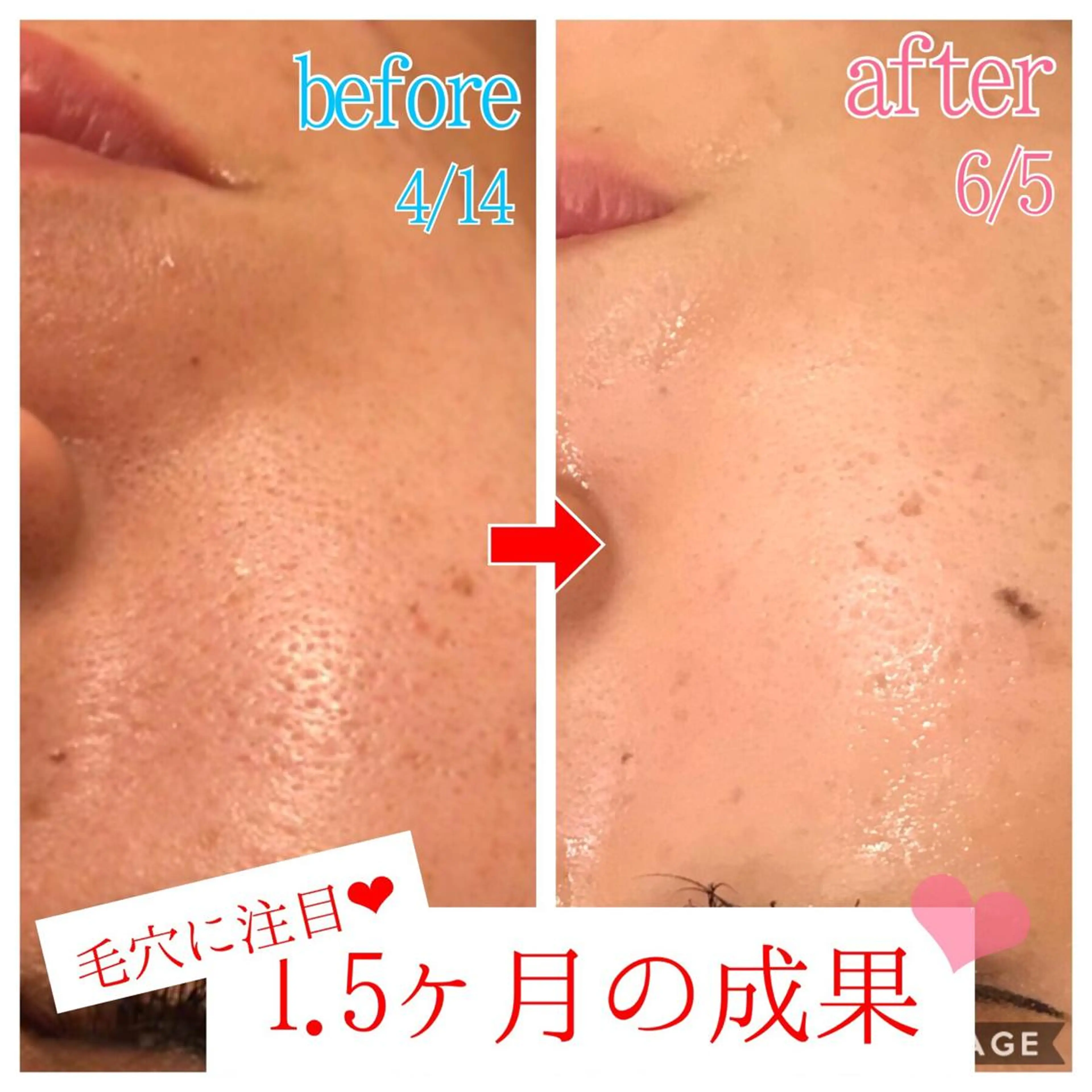 ロング カラー パーマ ヘアアレンジ メンズ キッズ ネイル マツエク・マツパ 四つ星サロン🎖 腸＆ニキビケアに特化のエステ・リラクイメージ