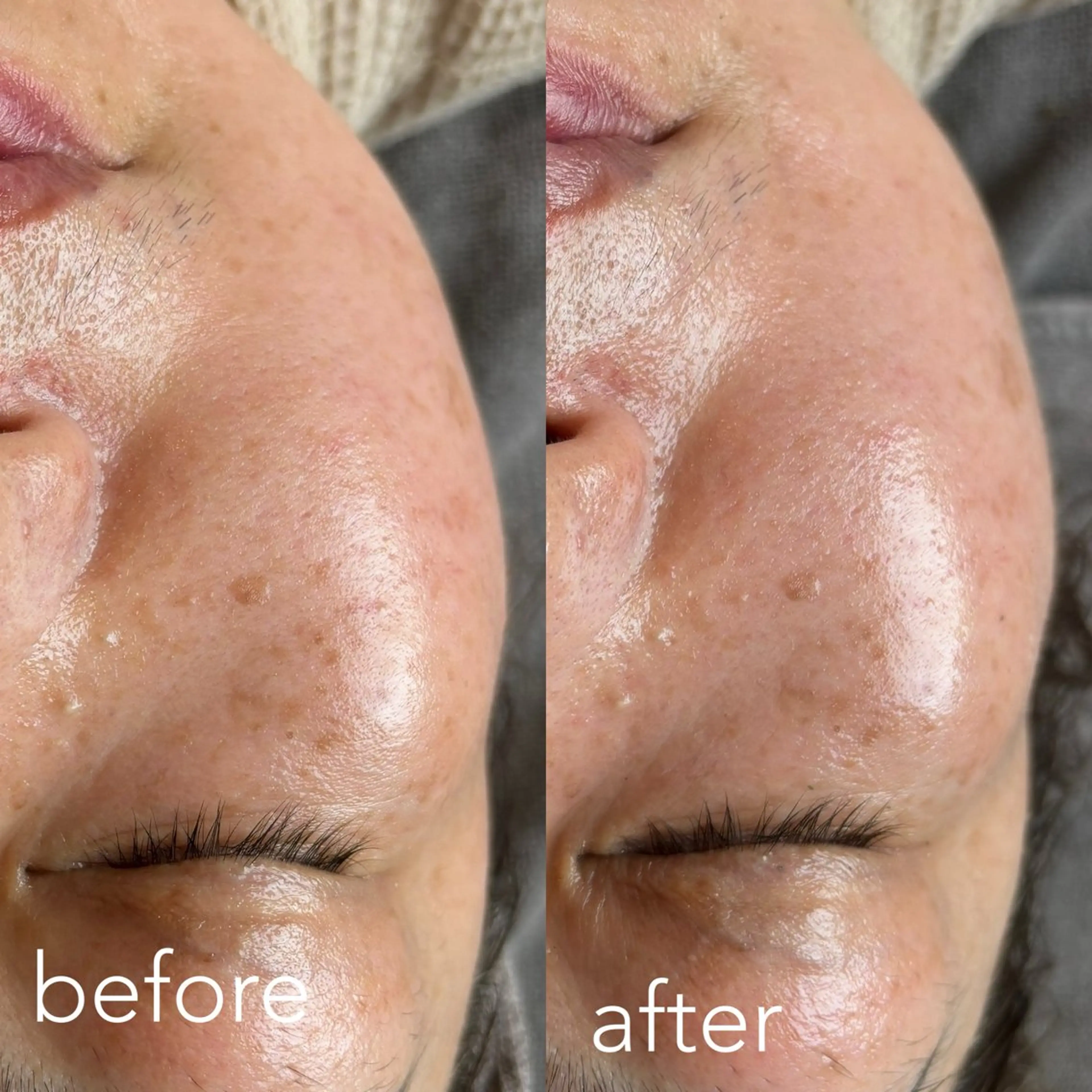 エステティックサロン Liente(リアンテ）所属・Hashimoto .のエステ・リラクイメージ