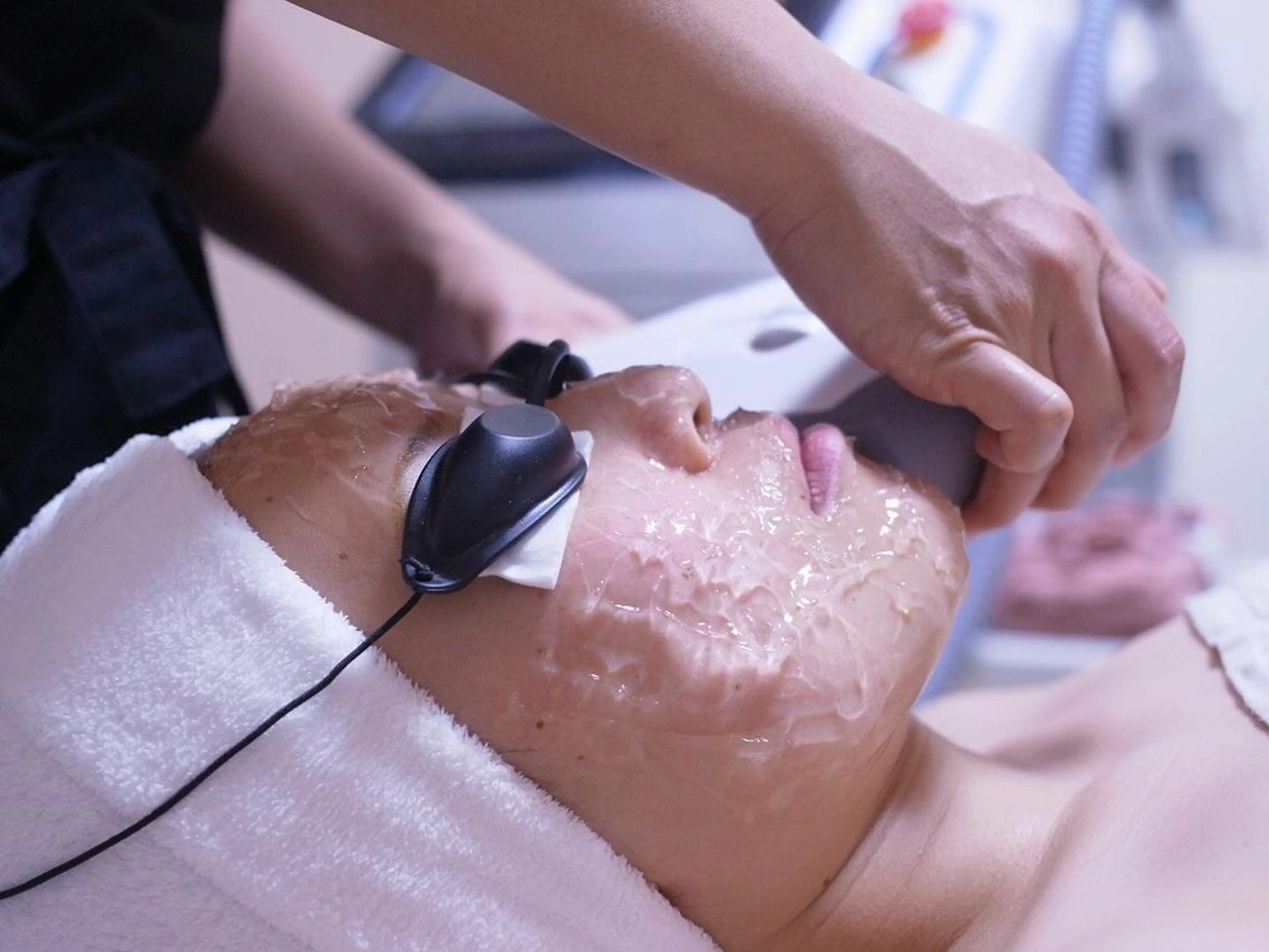 【お顔脱毛】毛穴レス美肌に✨気になる口周りは重ね打ちします！の写真