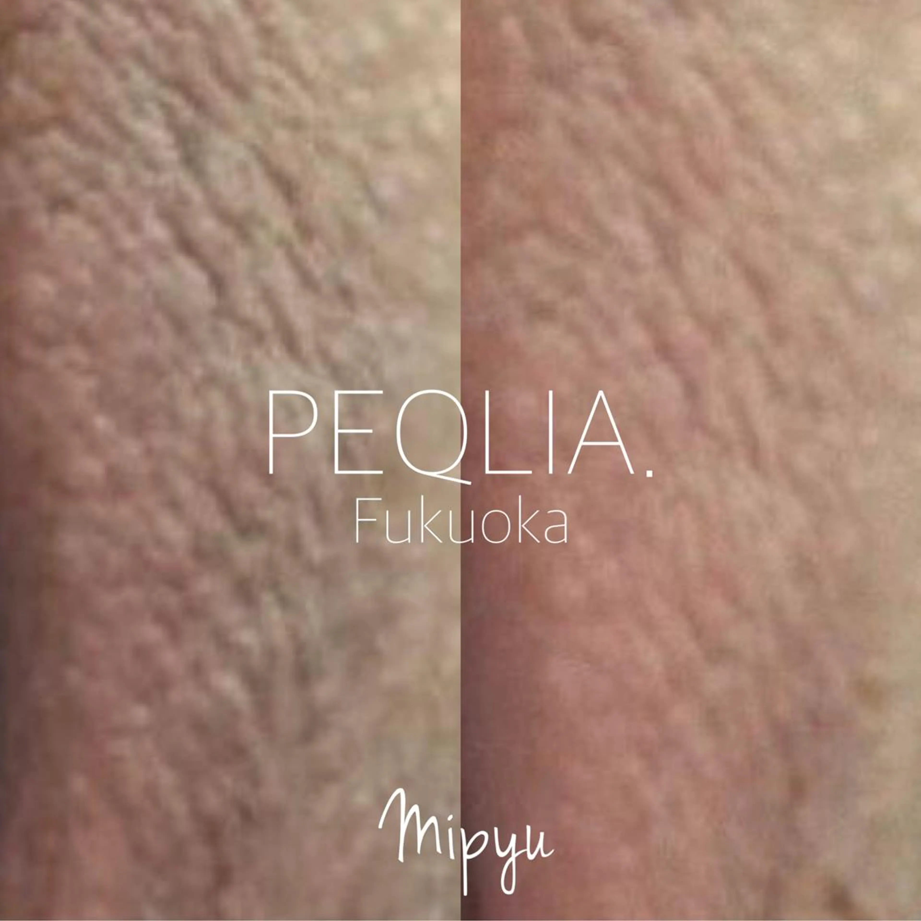 【最新メラニンケア/Mipyu】VIゾーン/アフタークリーム1ヶ月分付の写真