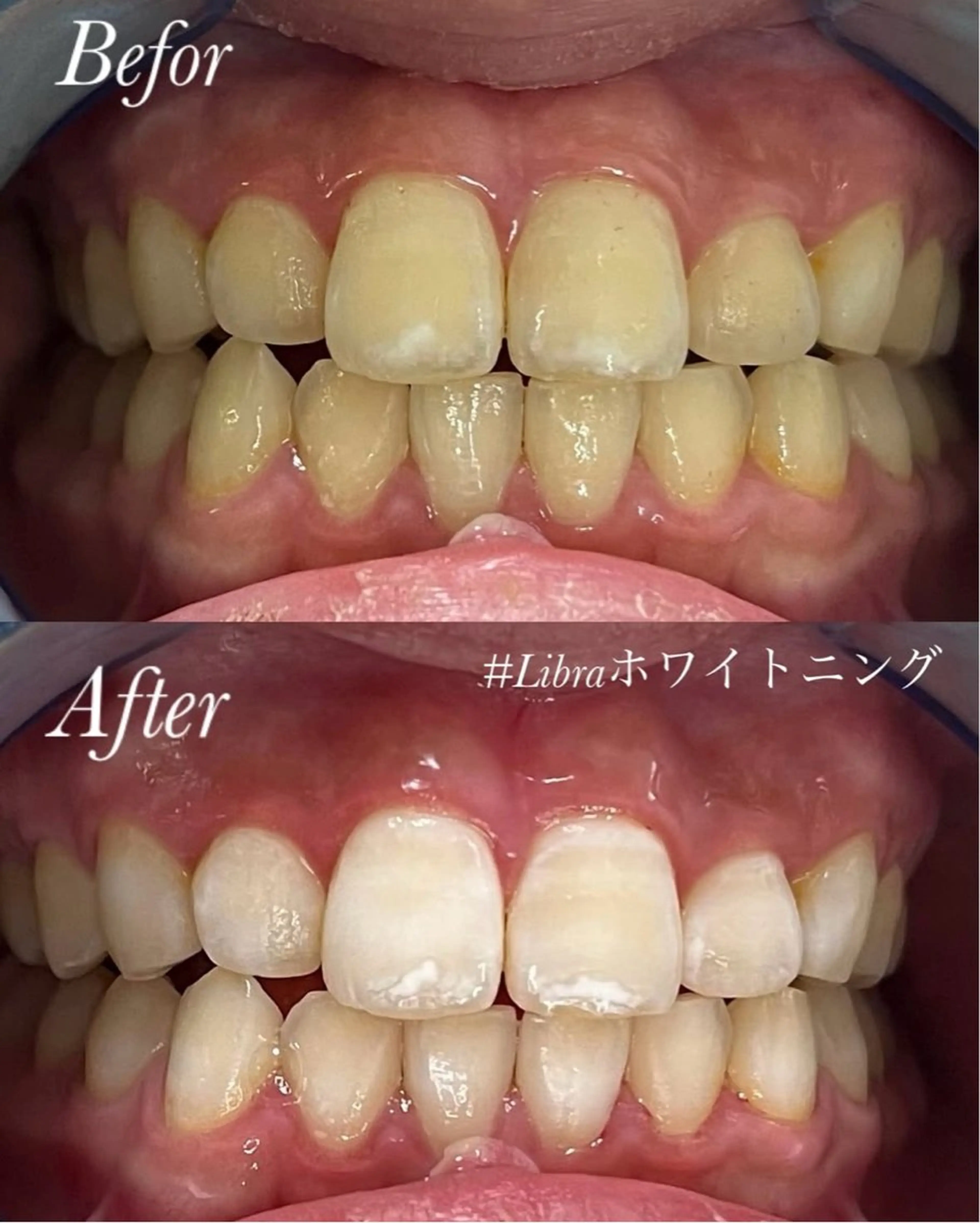 Libra所属・Libra 脱毛/ホワイトニングのその他イメージ
