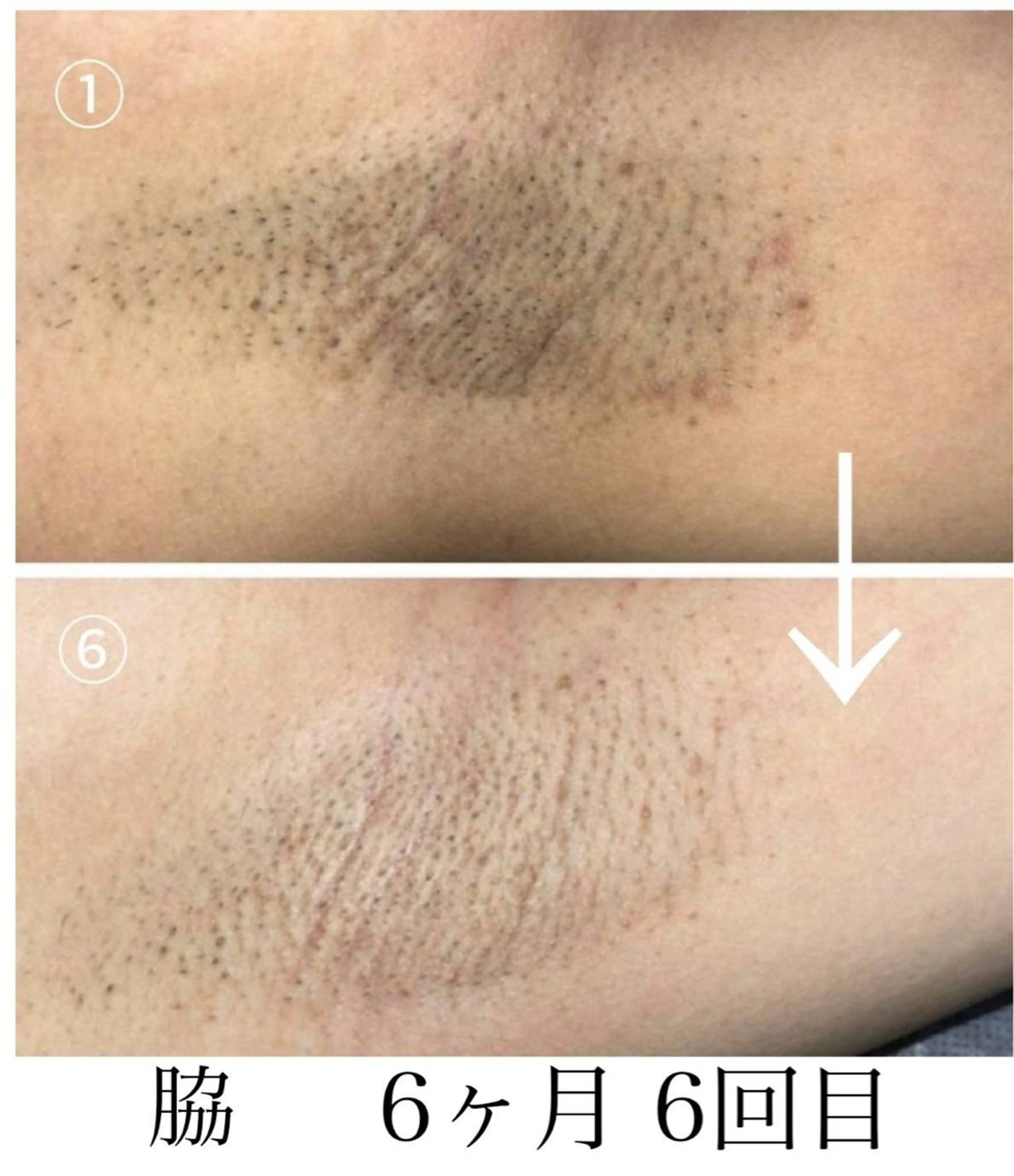 脱毛 Belle ＋vi（ベル）のその他イメージ