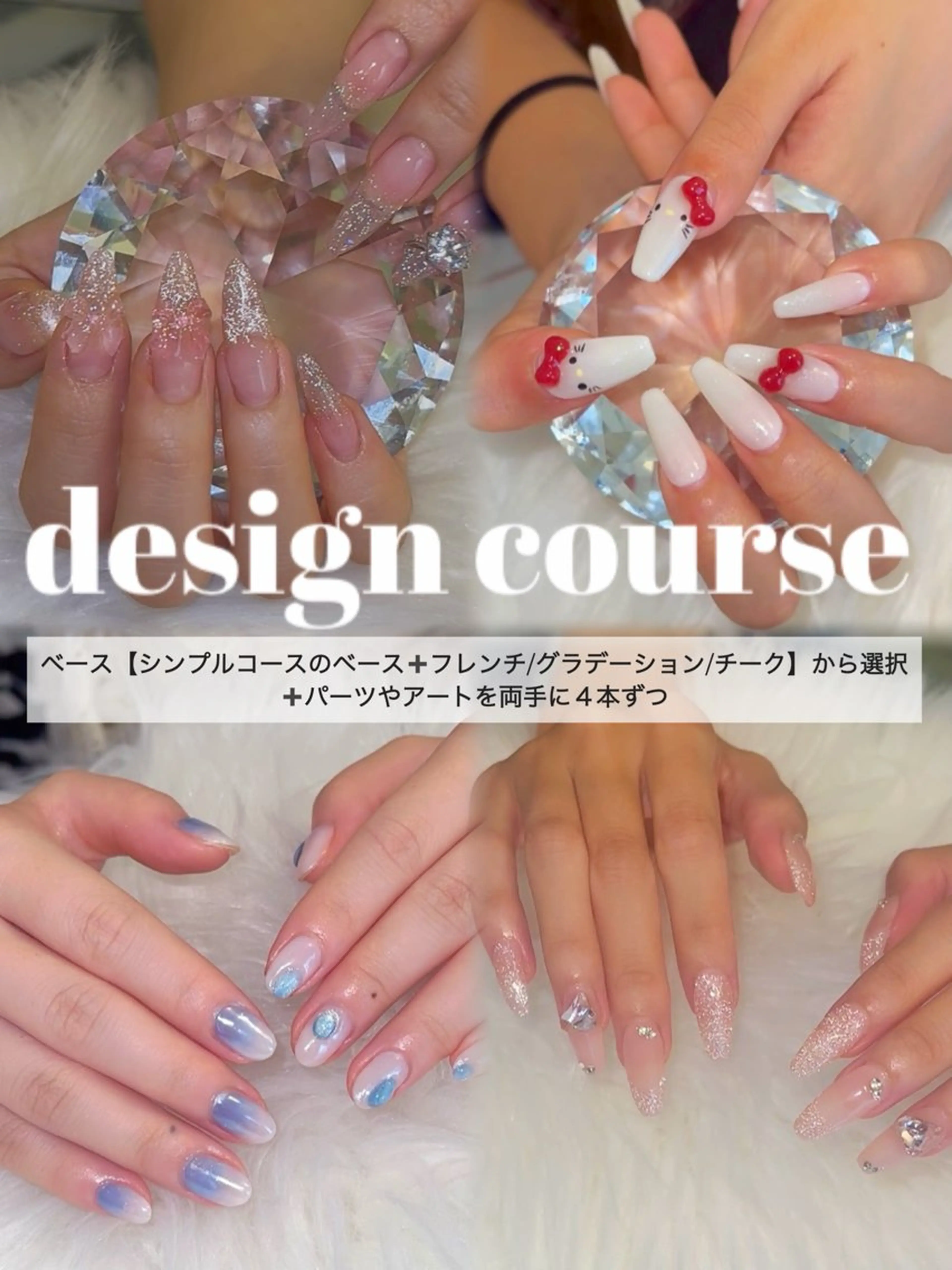 【Jr.価格】デザインアート4本コース（オフ・ケア無料）の写真