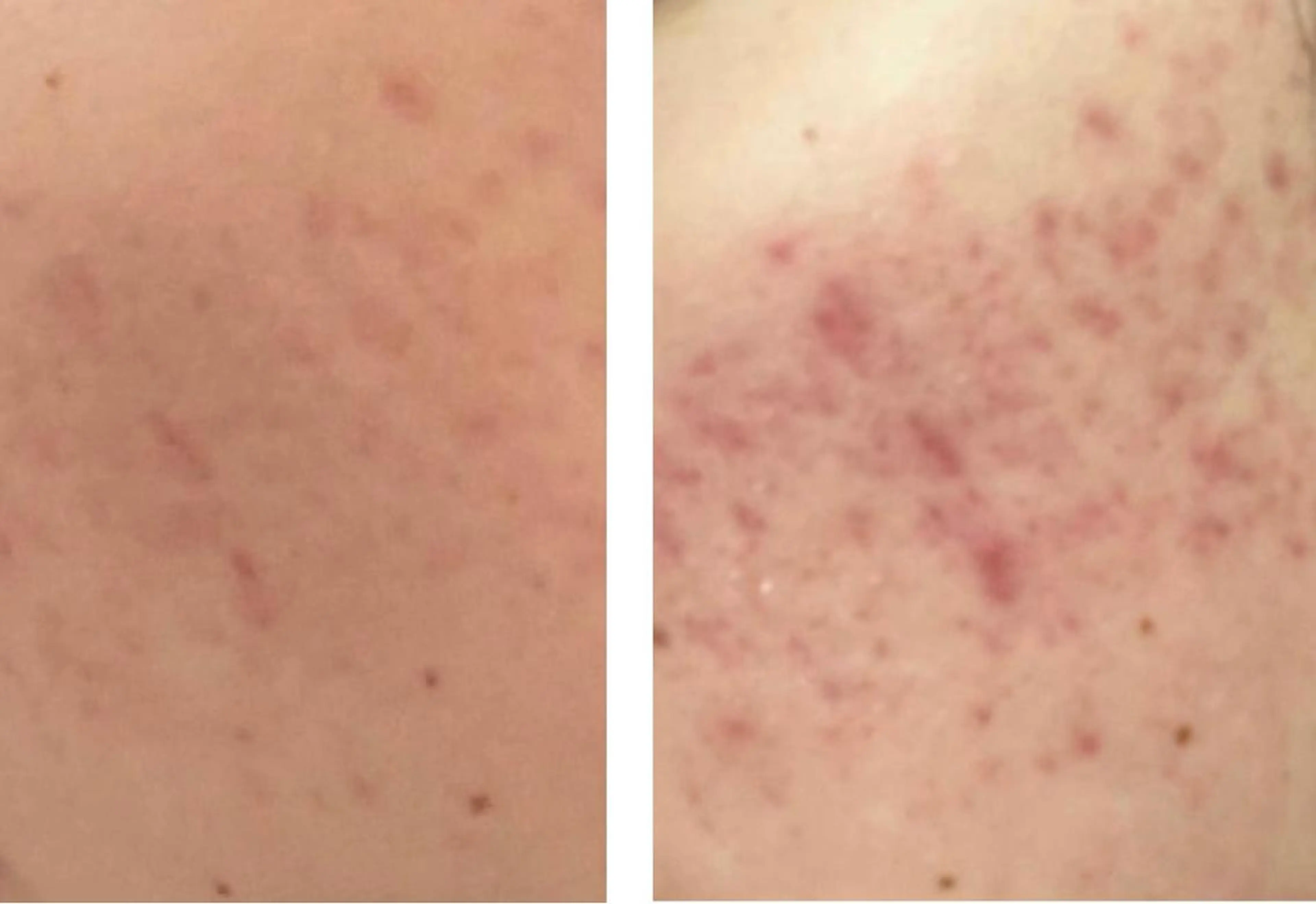 セミロング カラー パーマ ヘアアレンジ メンズ キッズ ネイル マツエク・マツパ アイブロウ エステ リラク ニキビ特化型エステ 🍓最短で肌質改善のその他イメージ