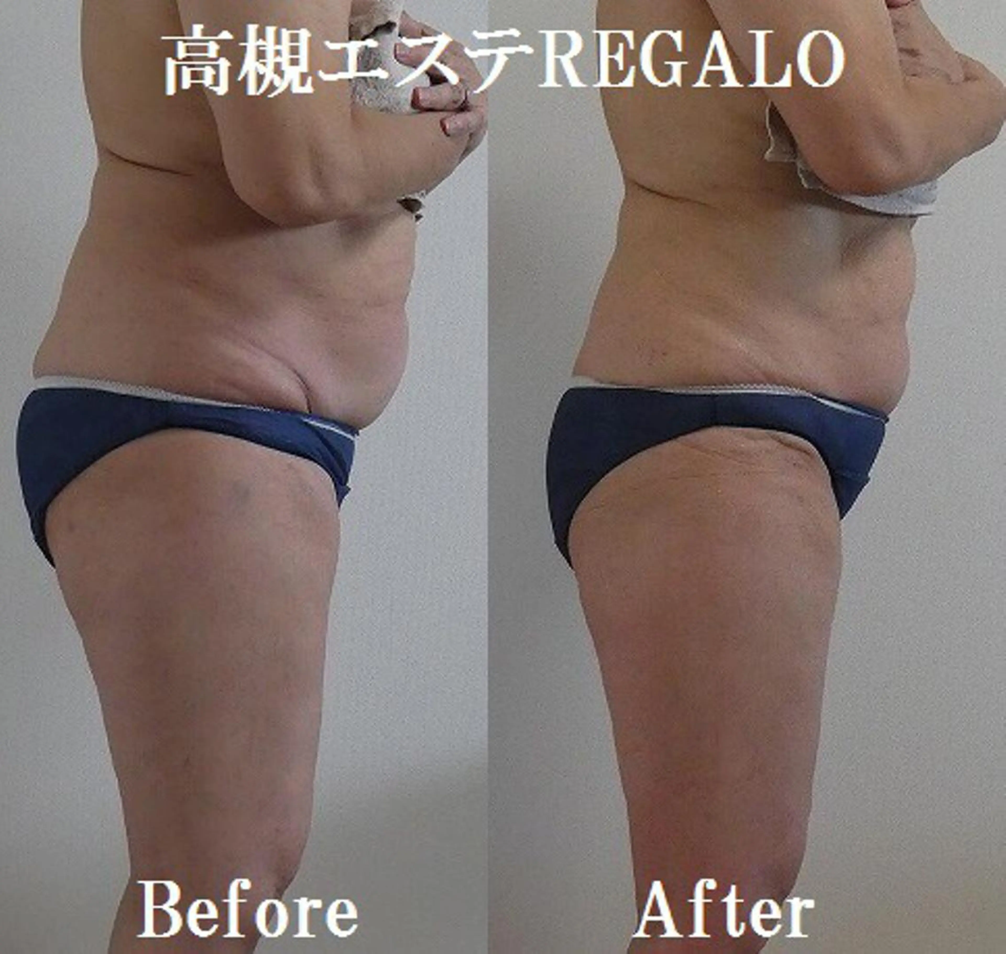 エステ リラク REGALO所属・矢野 さやかのエステ・リラクイメージ