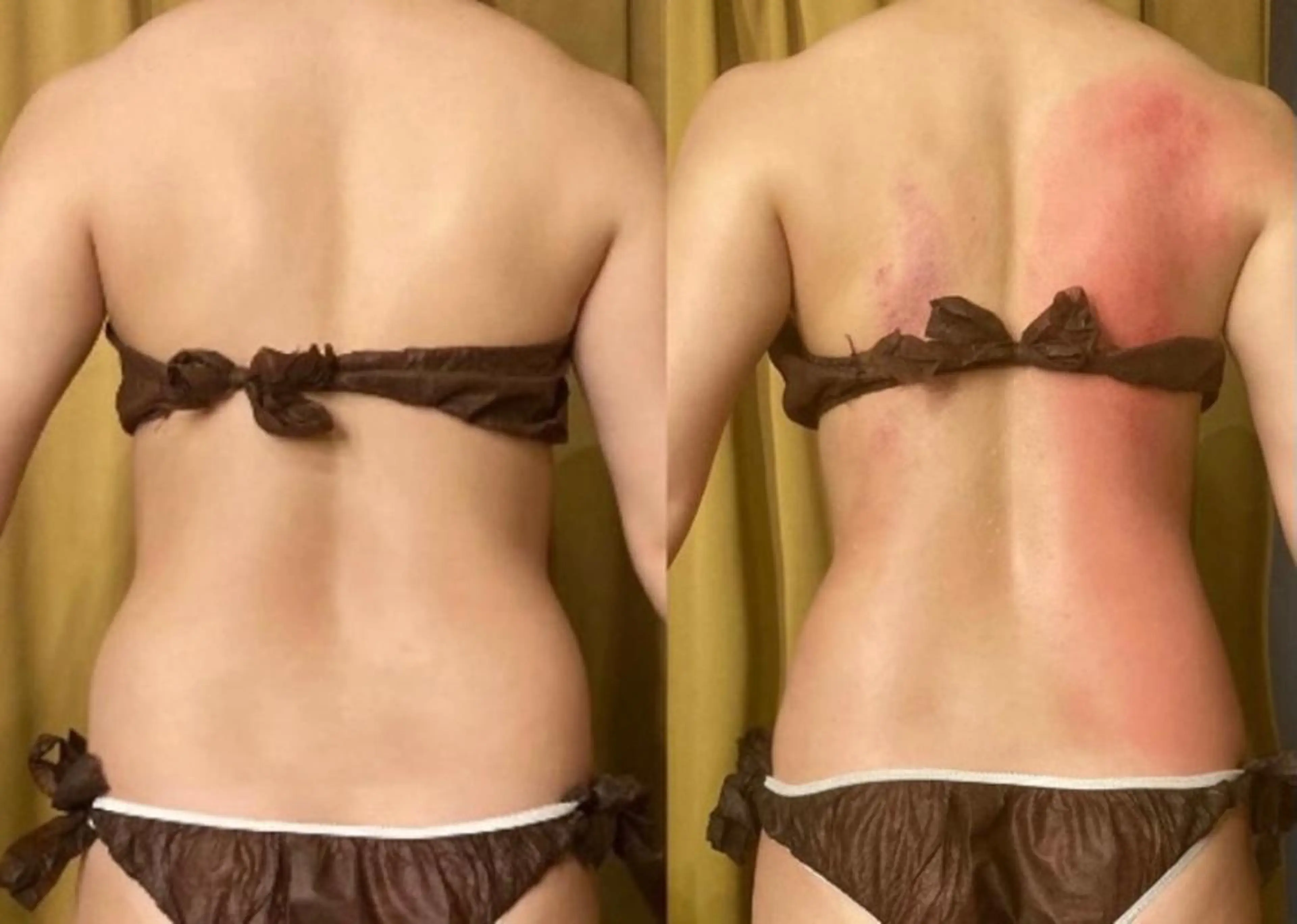 小顔やたるみに特化 💚野瀬可蓮のその他イメージ