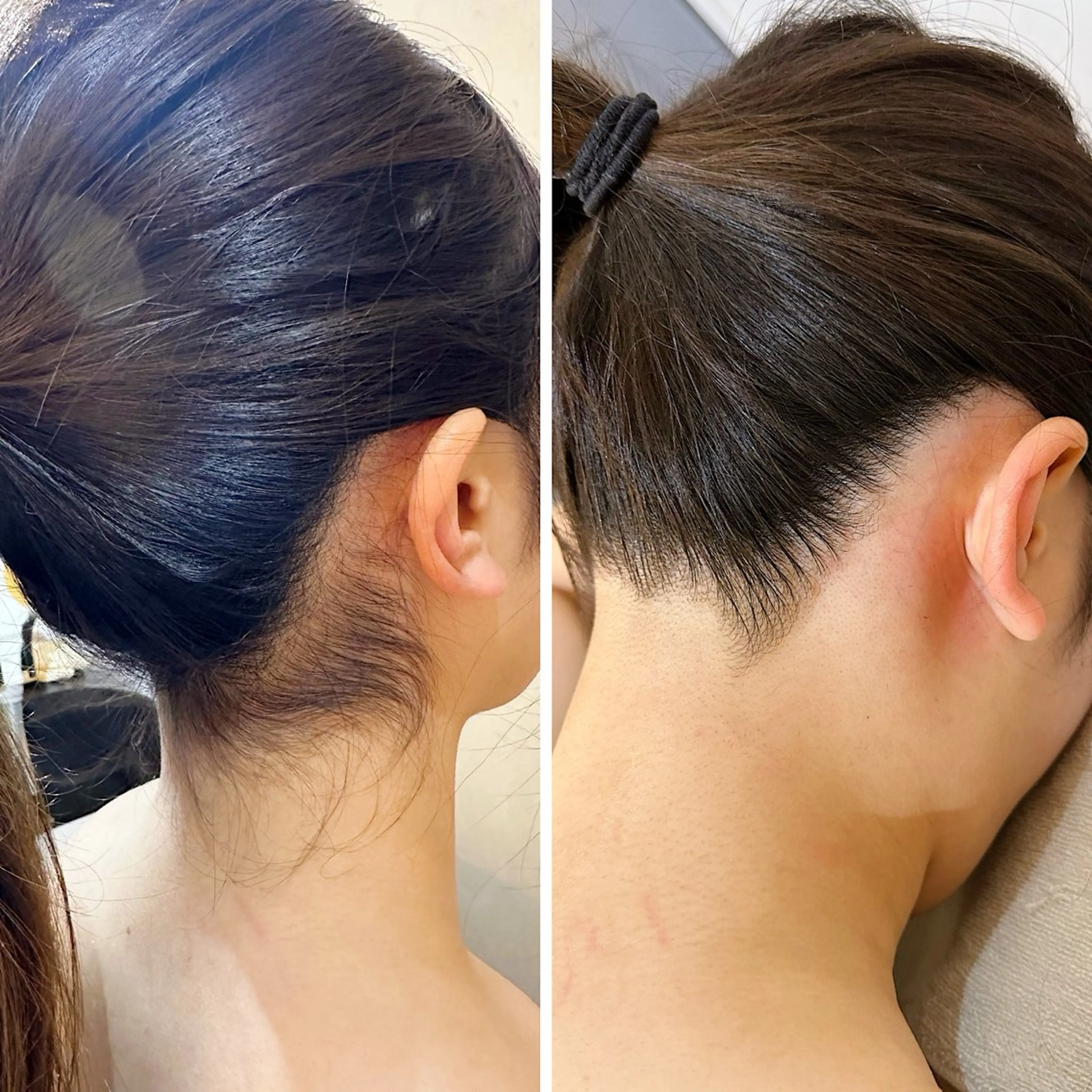 うなじ脱毛/美肌脱毛 LABELのエステ・リラクイメージ