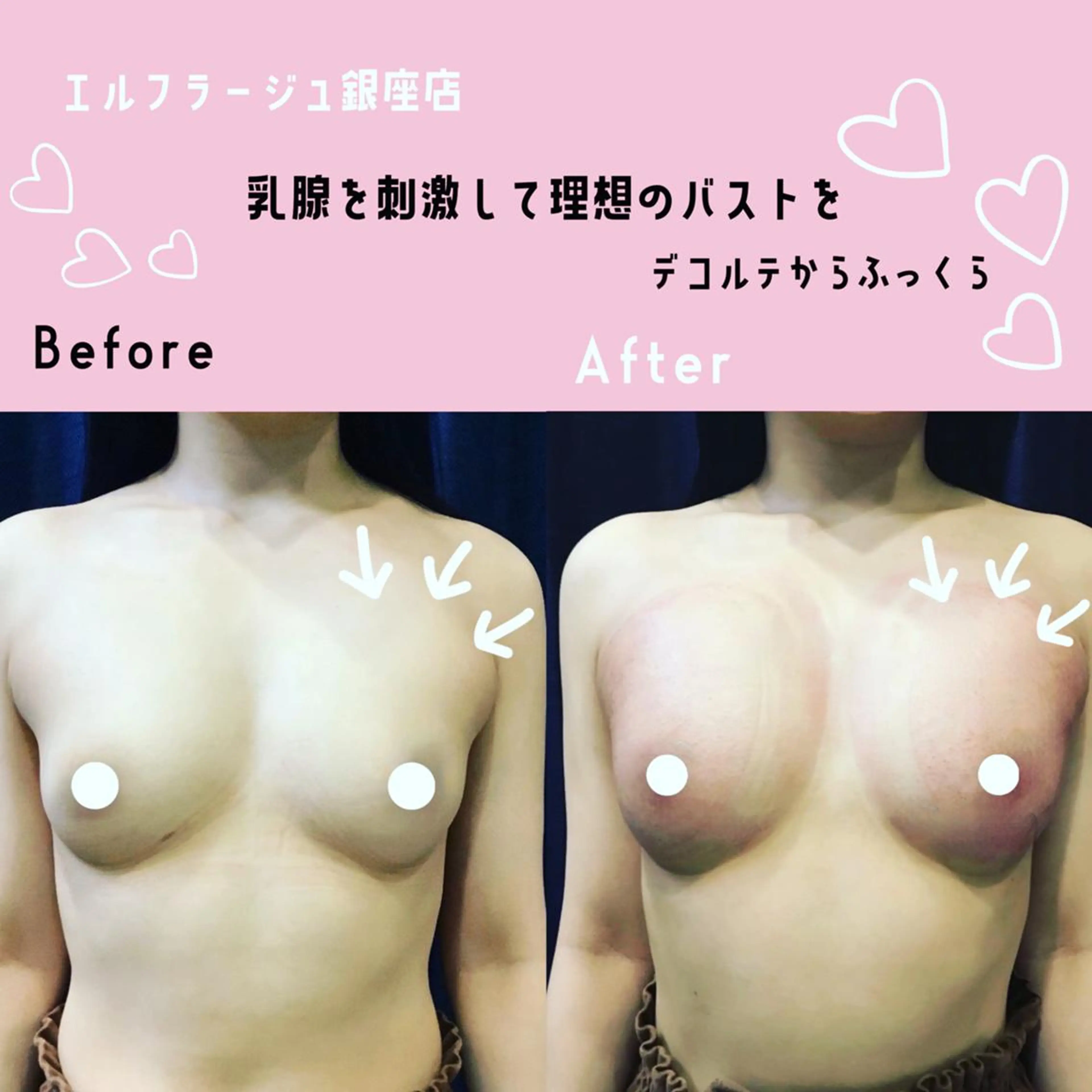 エルフラージュ 銀座店のエステ・リラクイメージ