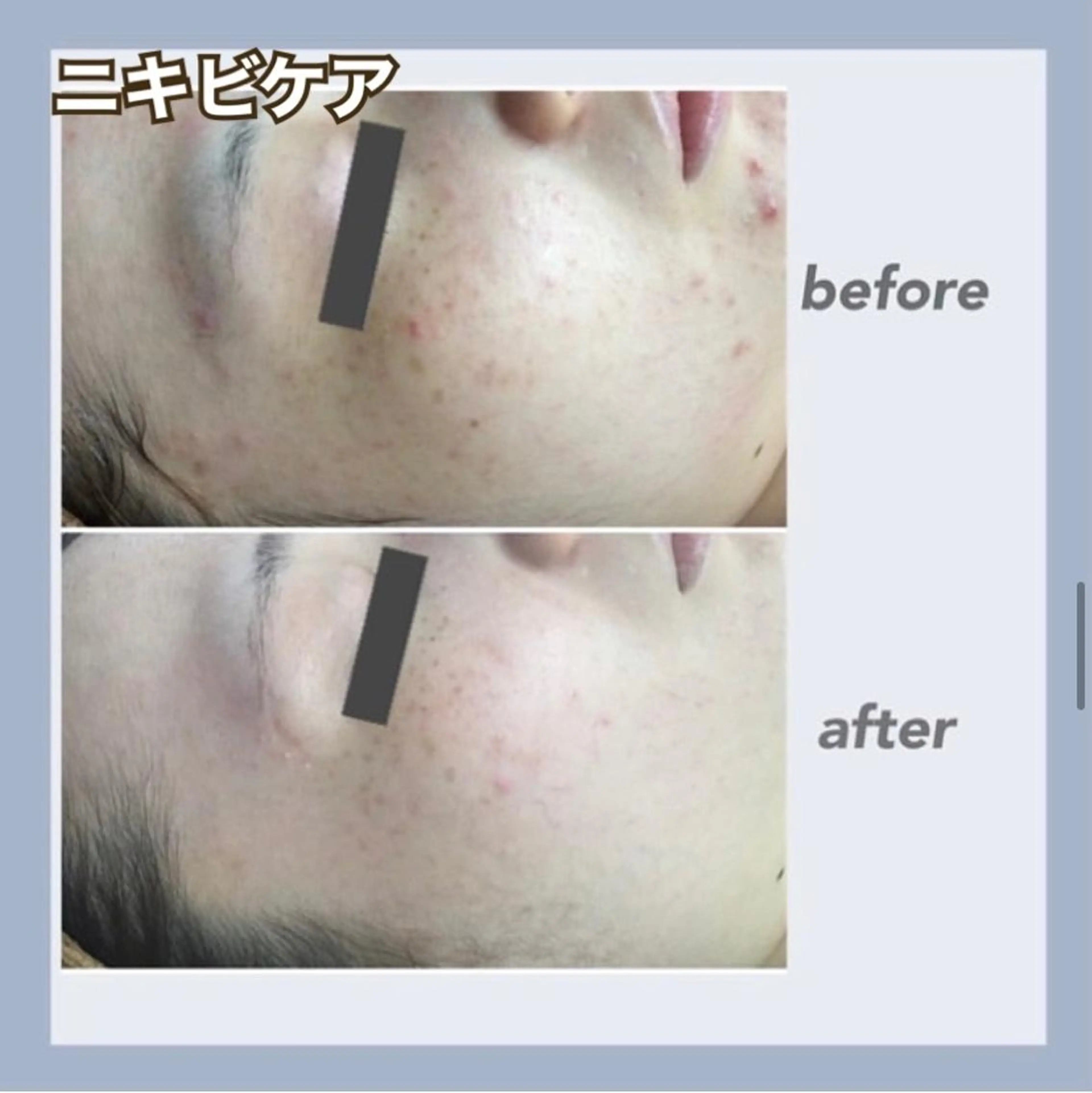 エステ RAYVIS 郡山店のエステ・リラクイメージ