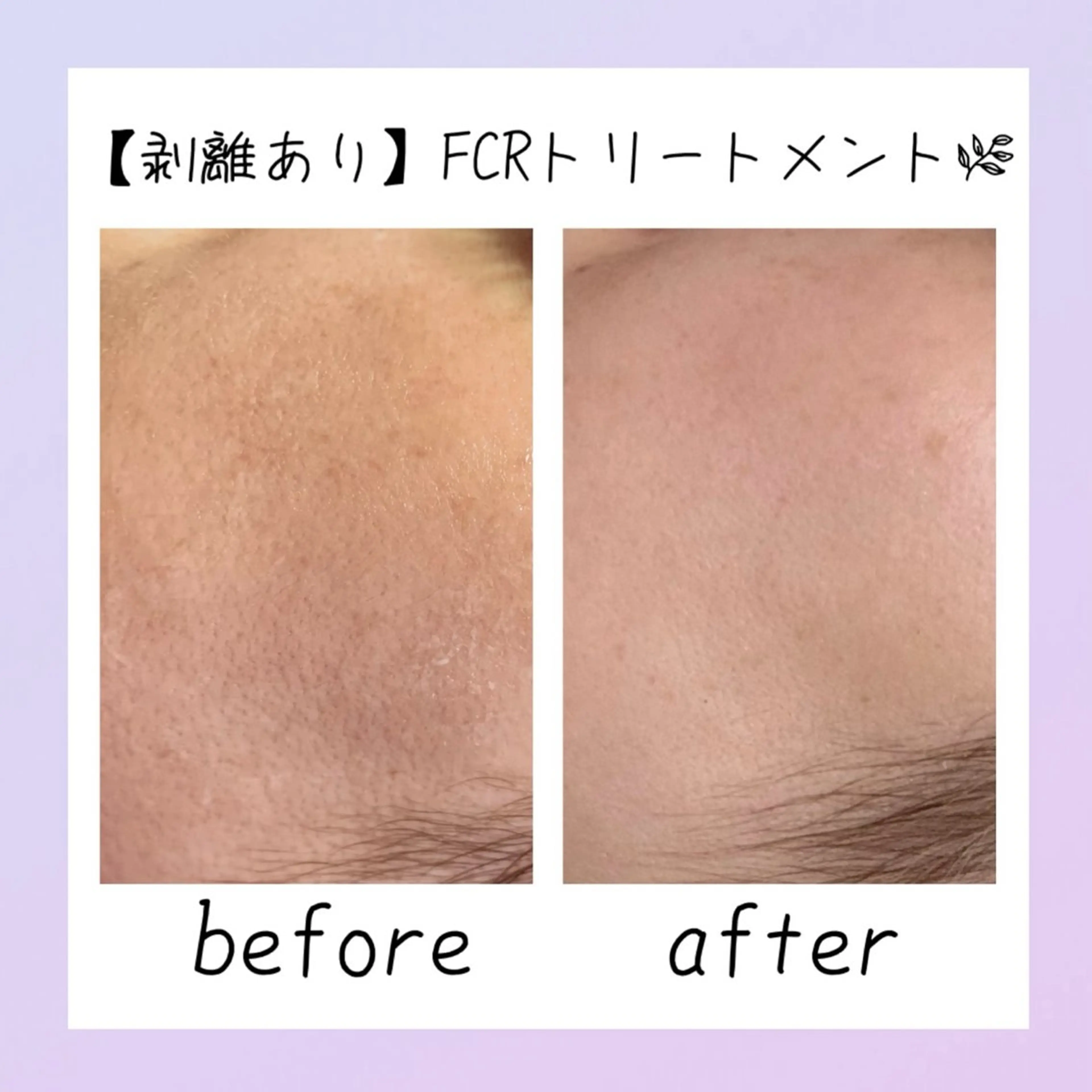 肌質改善Charme coco  増毛のエステ・リラクイメージ