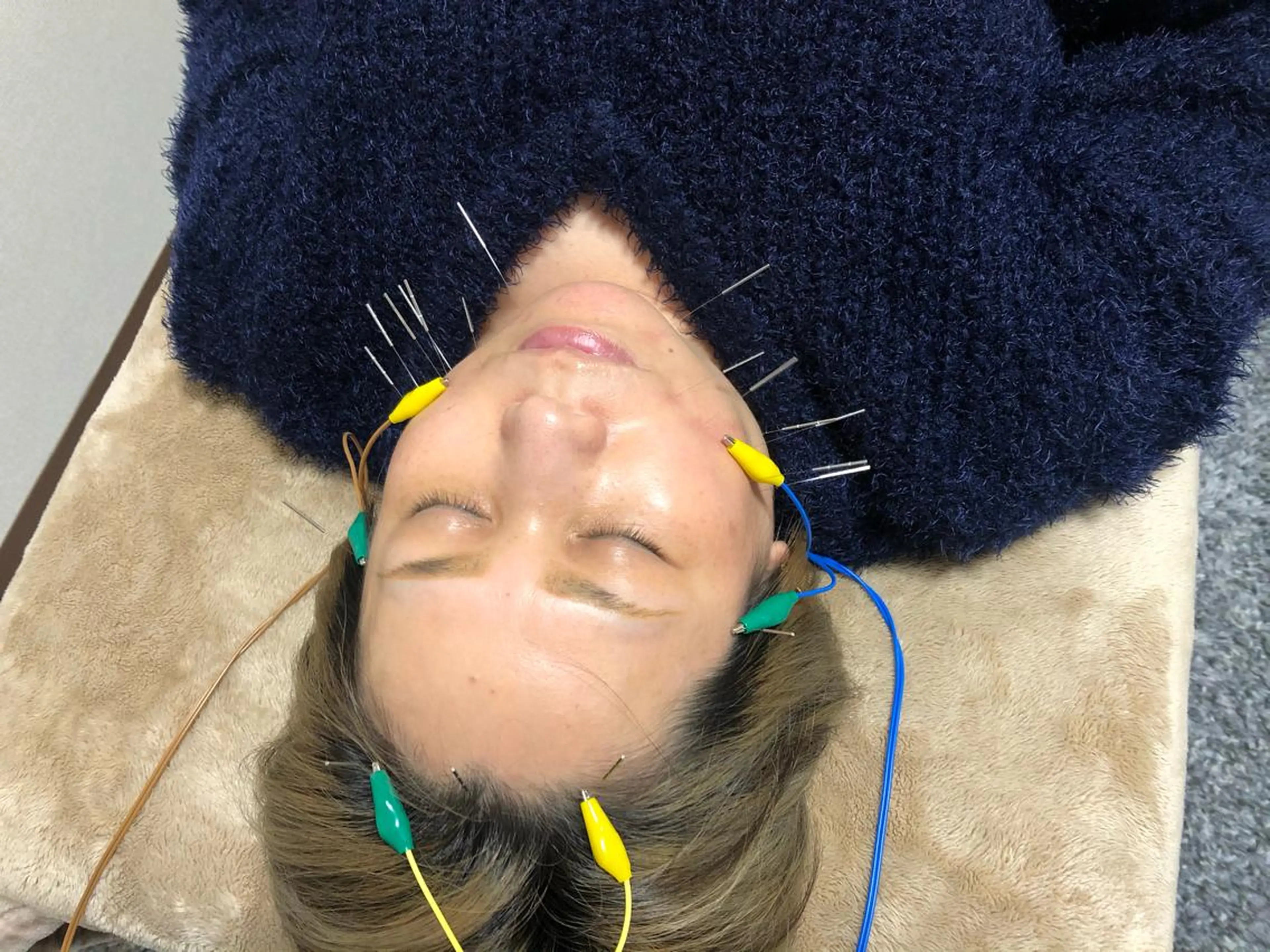 エステ リラク やはた鍼灸整骨院所属・やはた 鍼灸整骨院のエステ・リラクイメージ