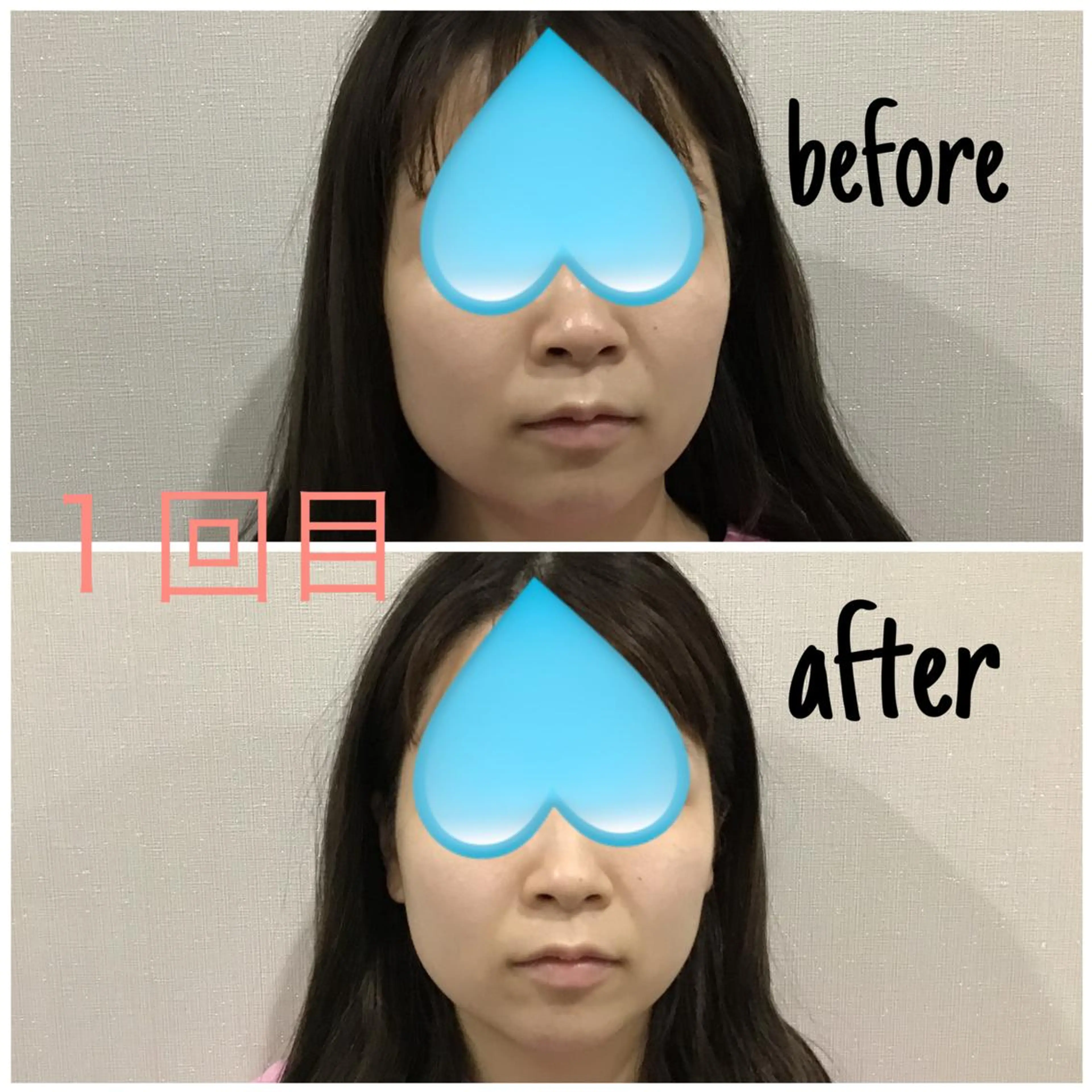 エステ 毛穴洗浄・痩身・脱毛 /アルカンジュのエステ・リラクイメージ