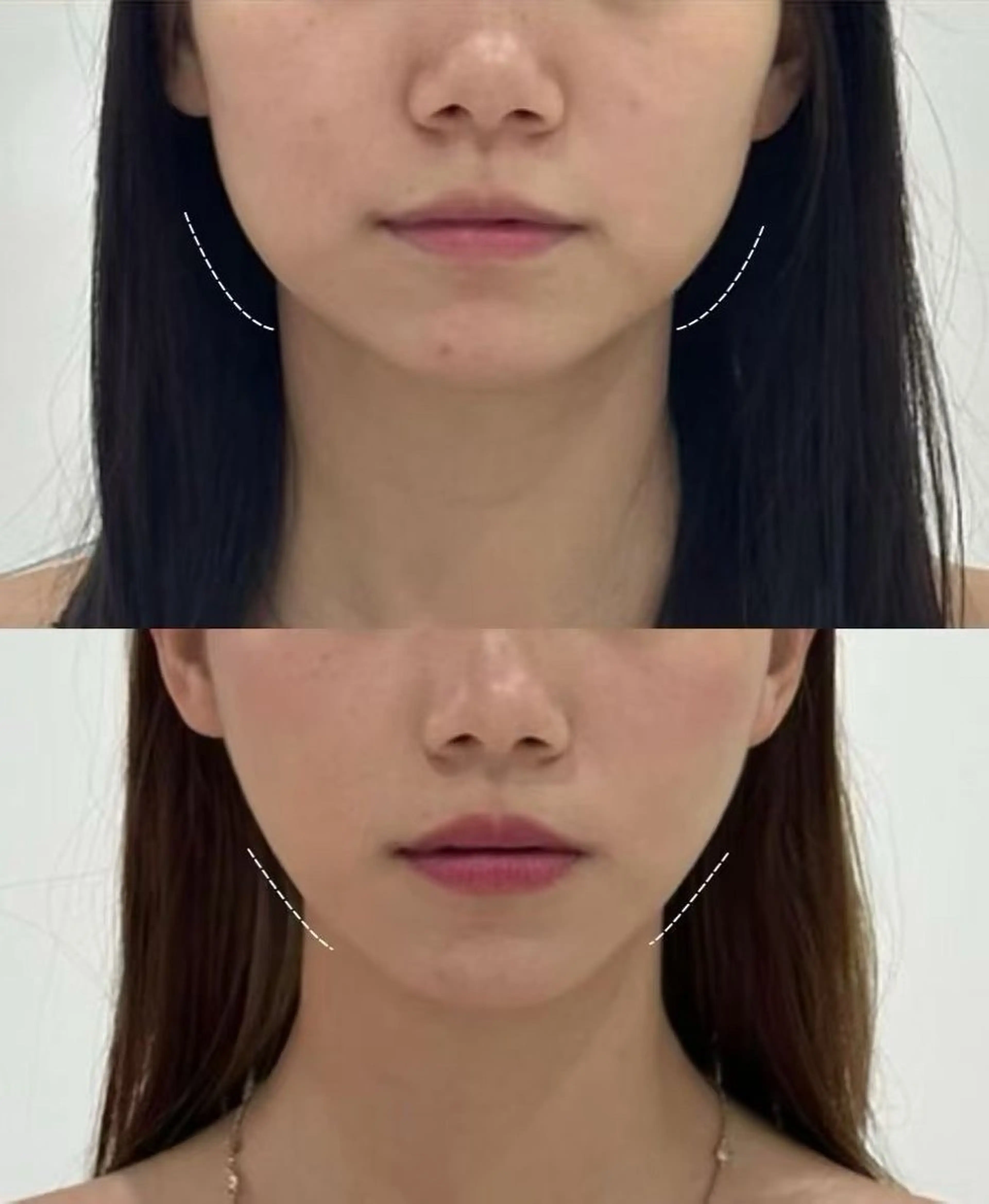 ネイル エステ aliaハイフ&水光ジェットサロン所属・aliaハーブ水光店 エステティシャン募集のエステ・リラクイメージ