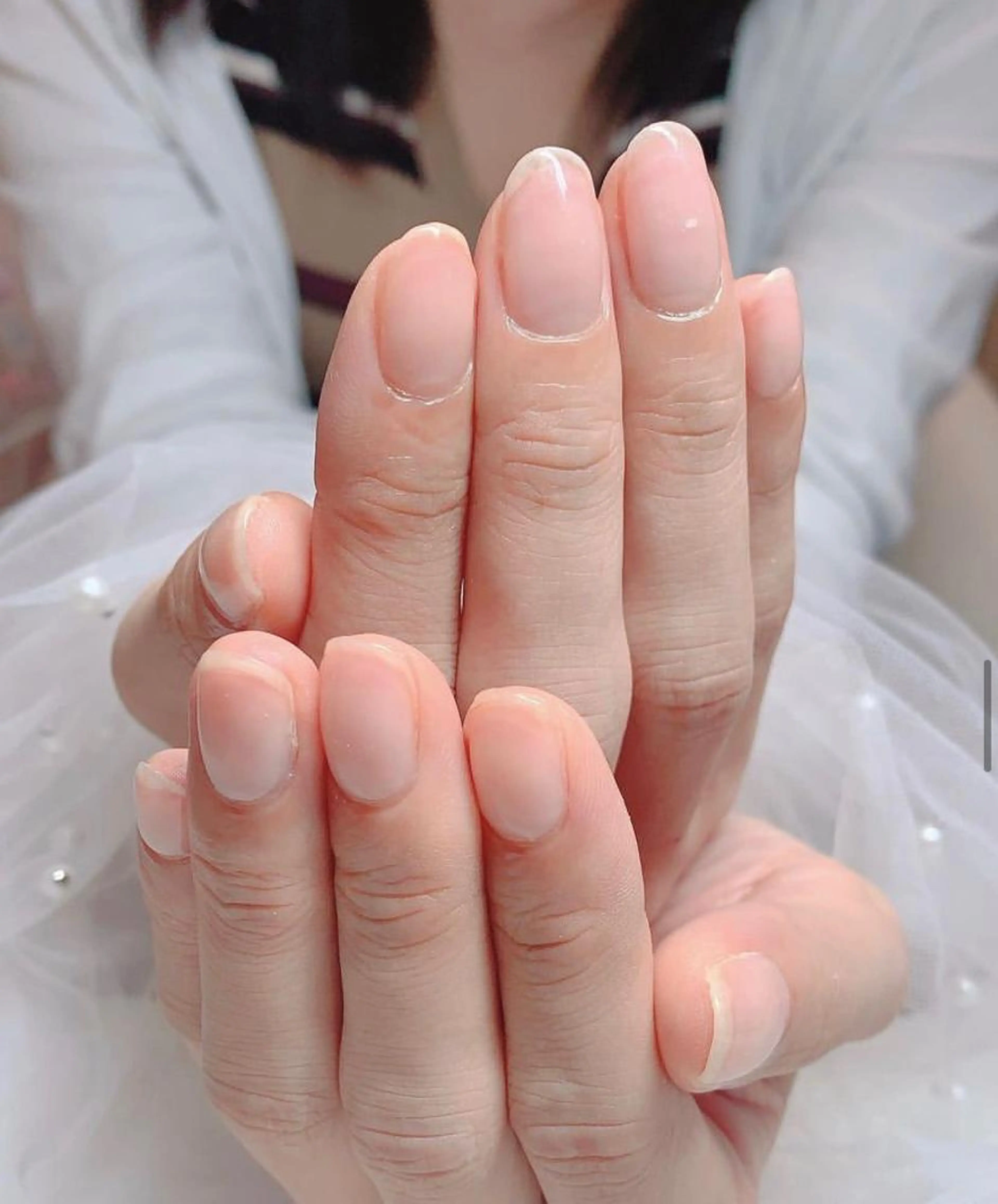 自爪育成クリア(オフ込み&ドライケア付き)の写真