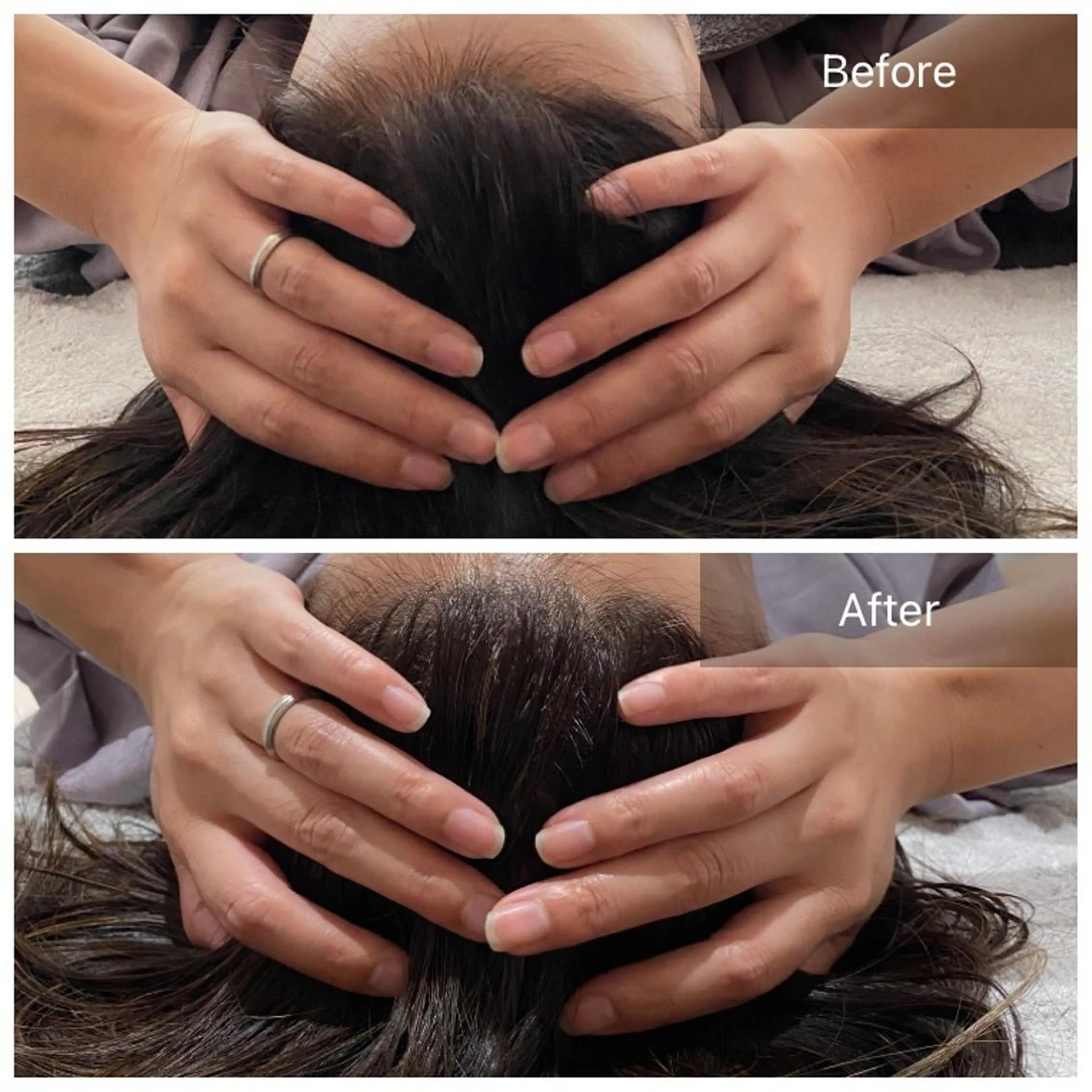 ドライヘッドマッサージの写真