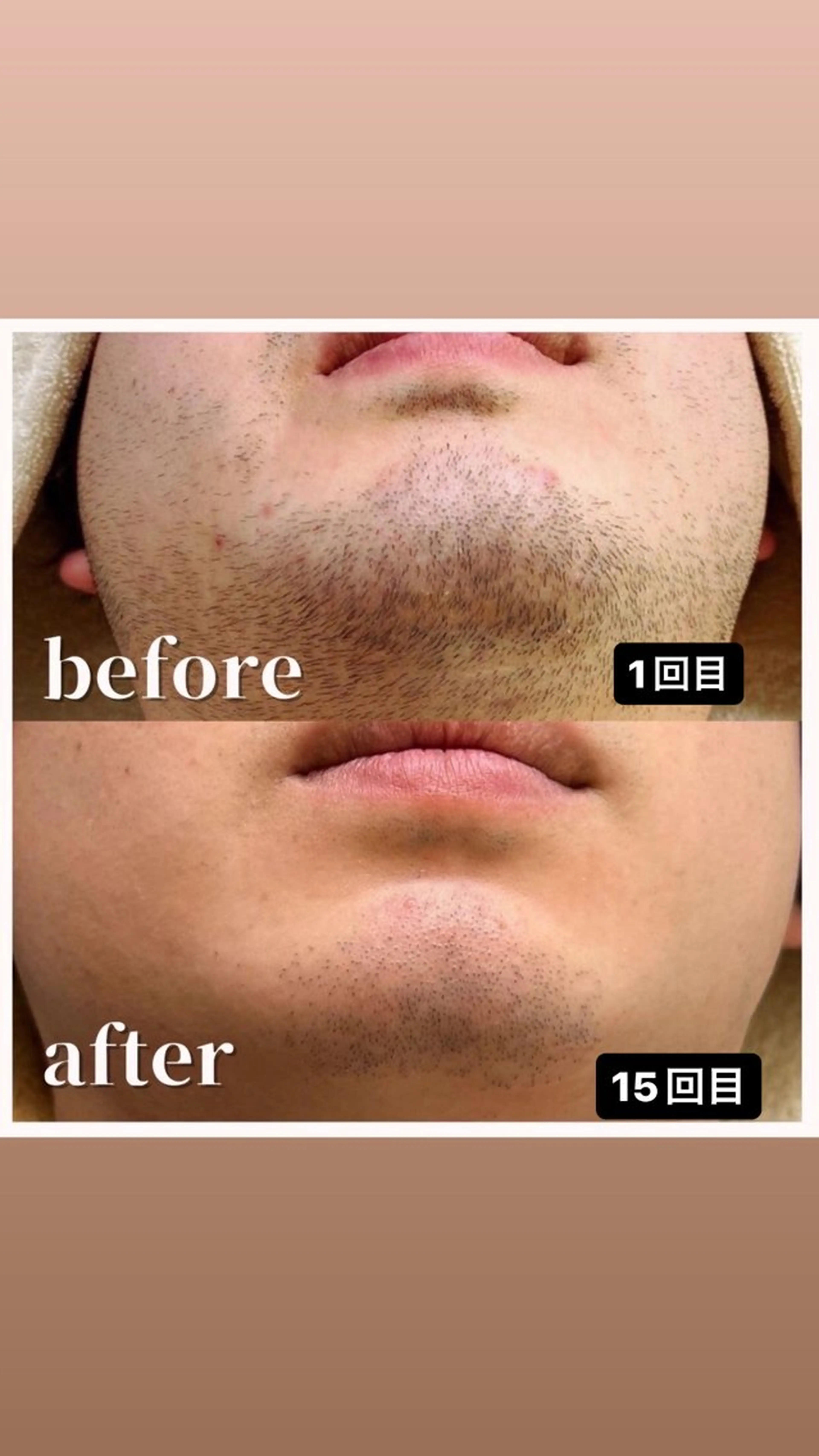 メンズ メンズ脱毛サロン kurozukinのエステ・リラクイメージ