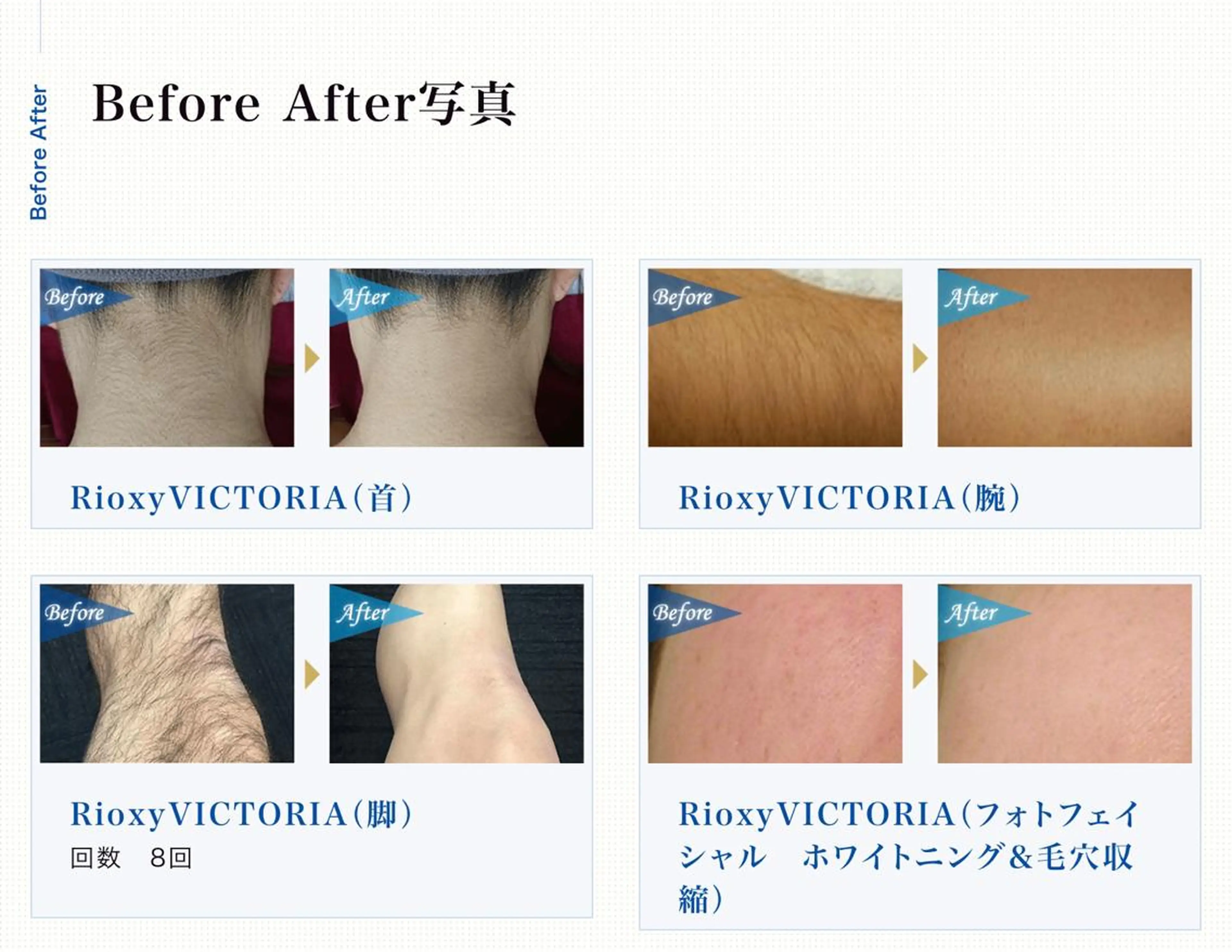 メンズ RemoreBeauty所属・Nakano Kazunariのエステ・リラクイメージ