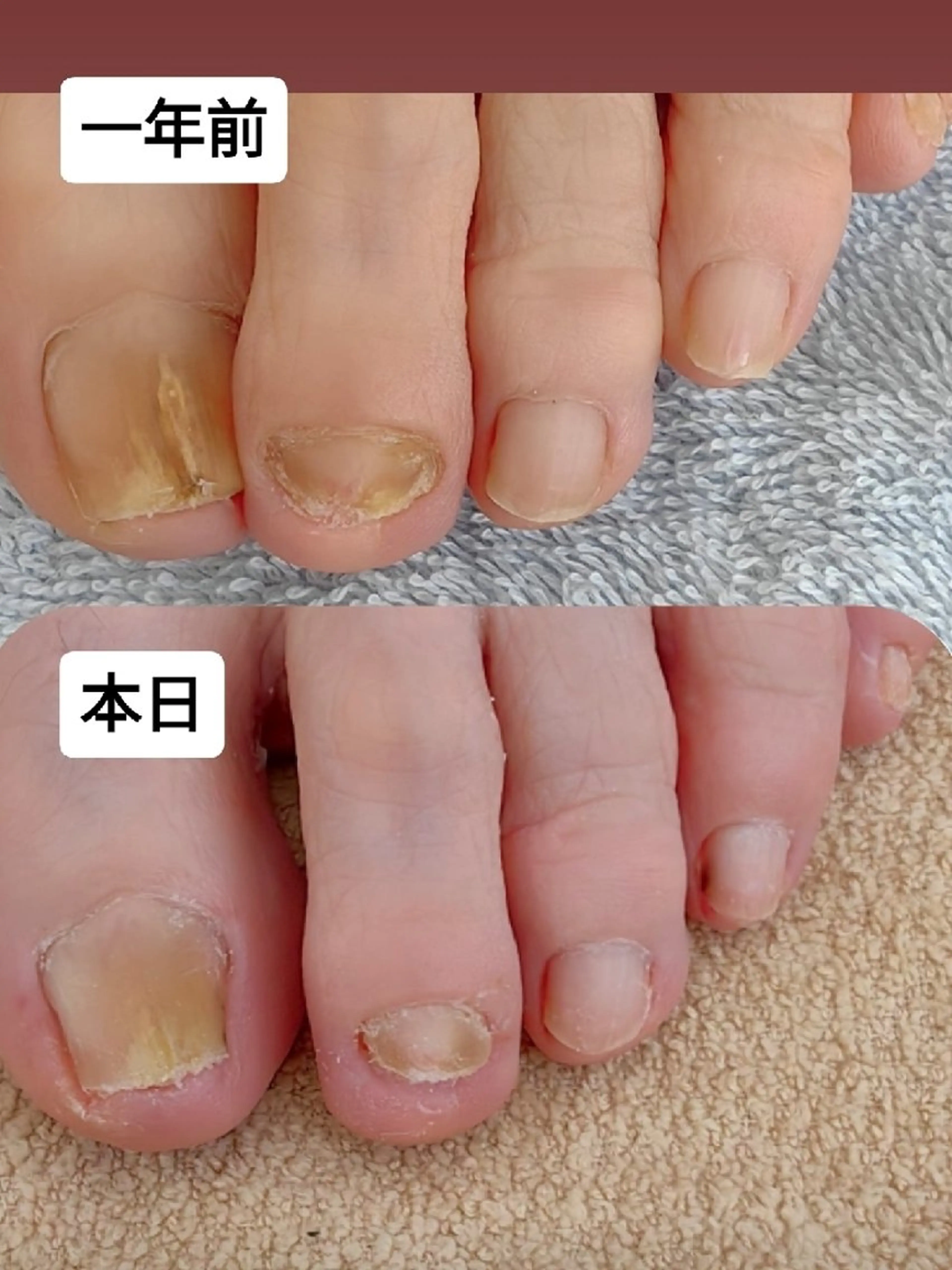 ネイル フットネイル reve あやののネイルデザイン