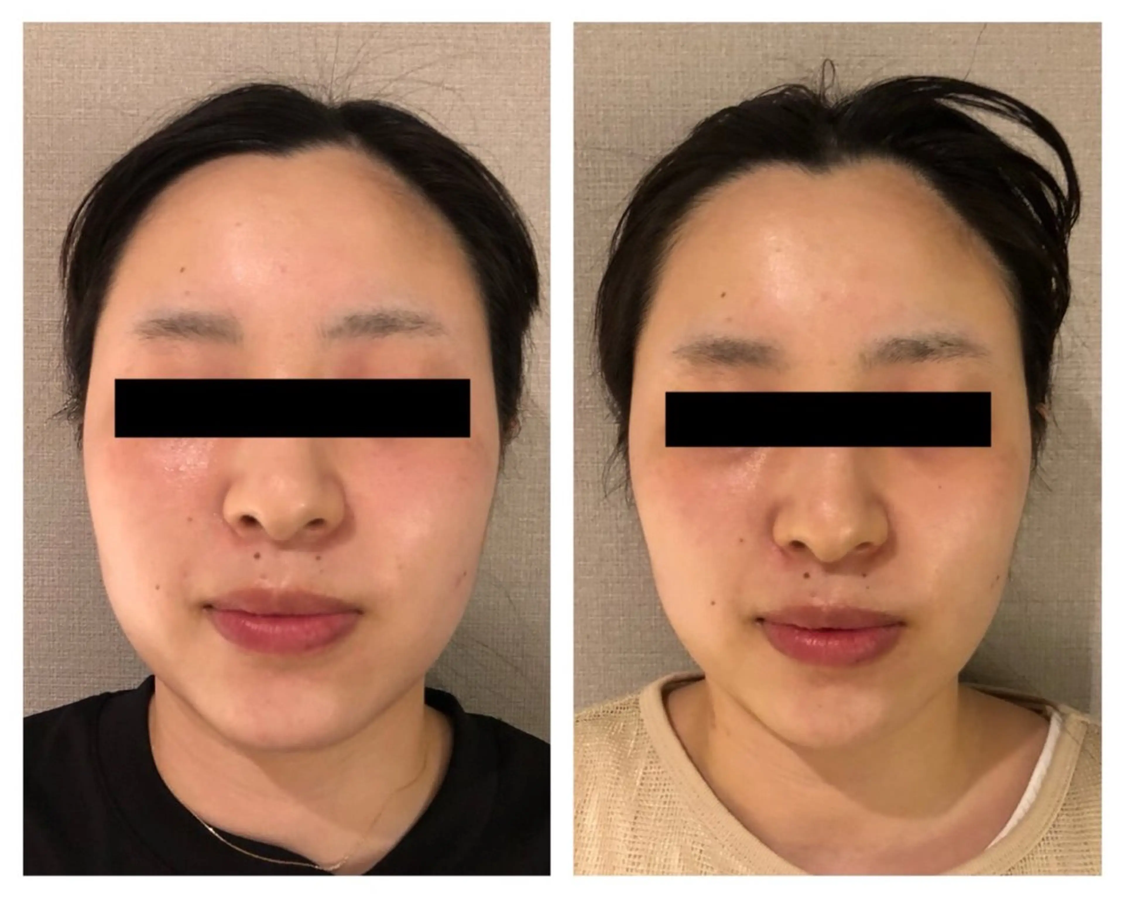 エステ 自由が丘📍 Belrougeのエステ・リラクイメージ