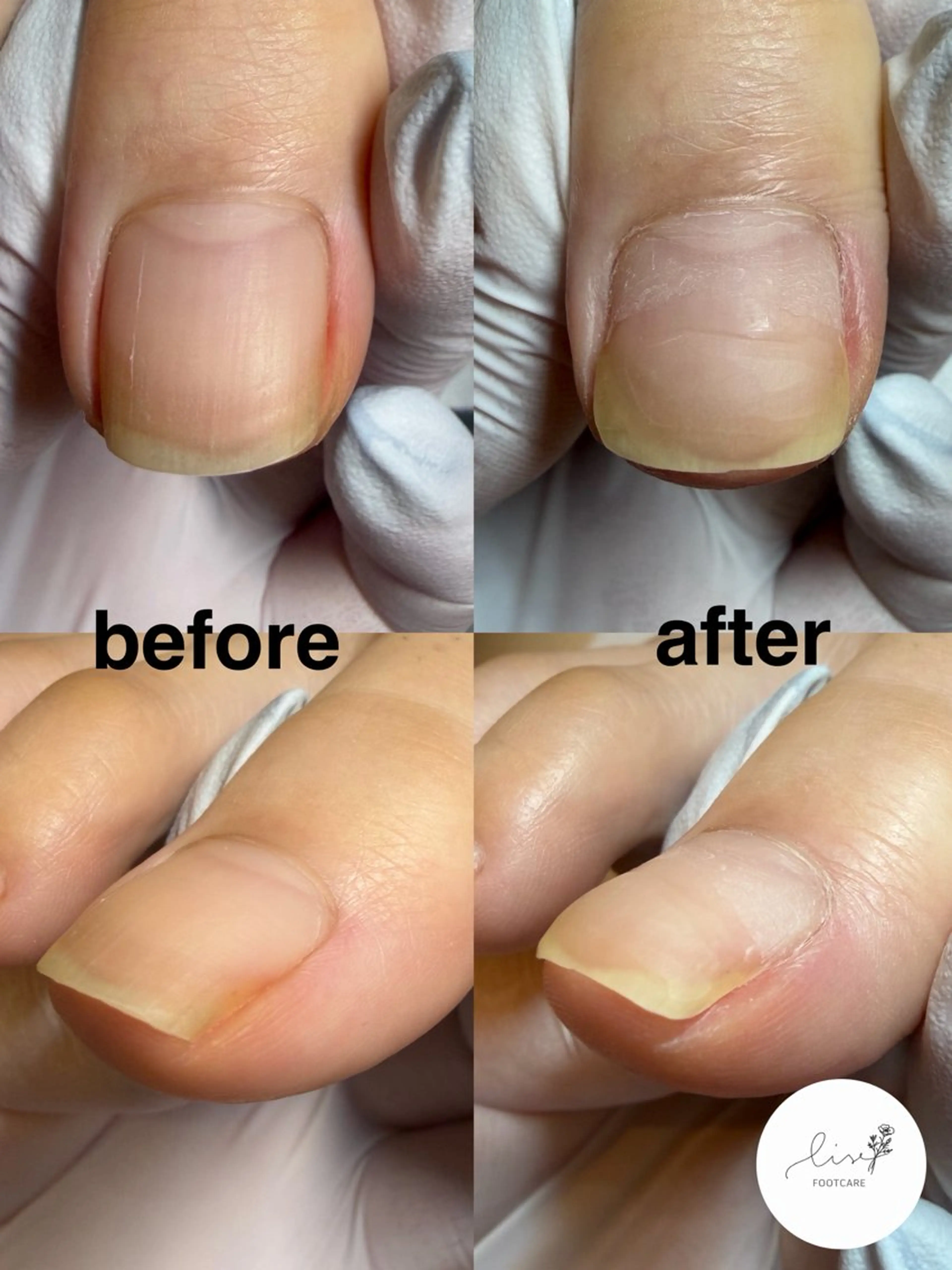 Lise footcareのネイルデザイン