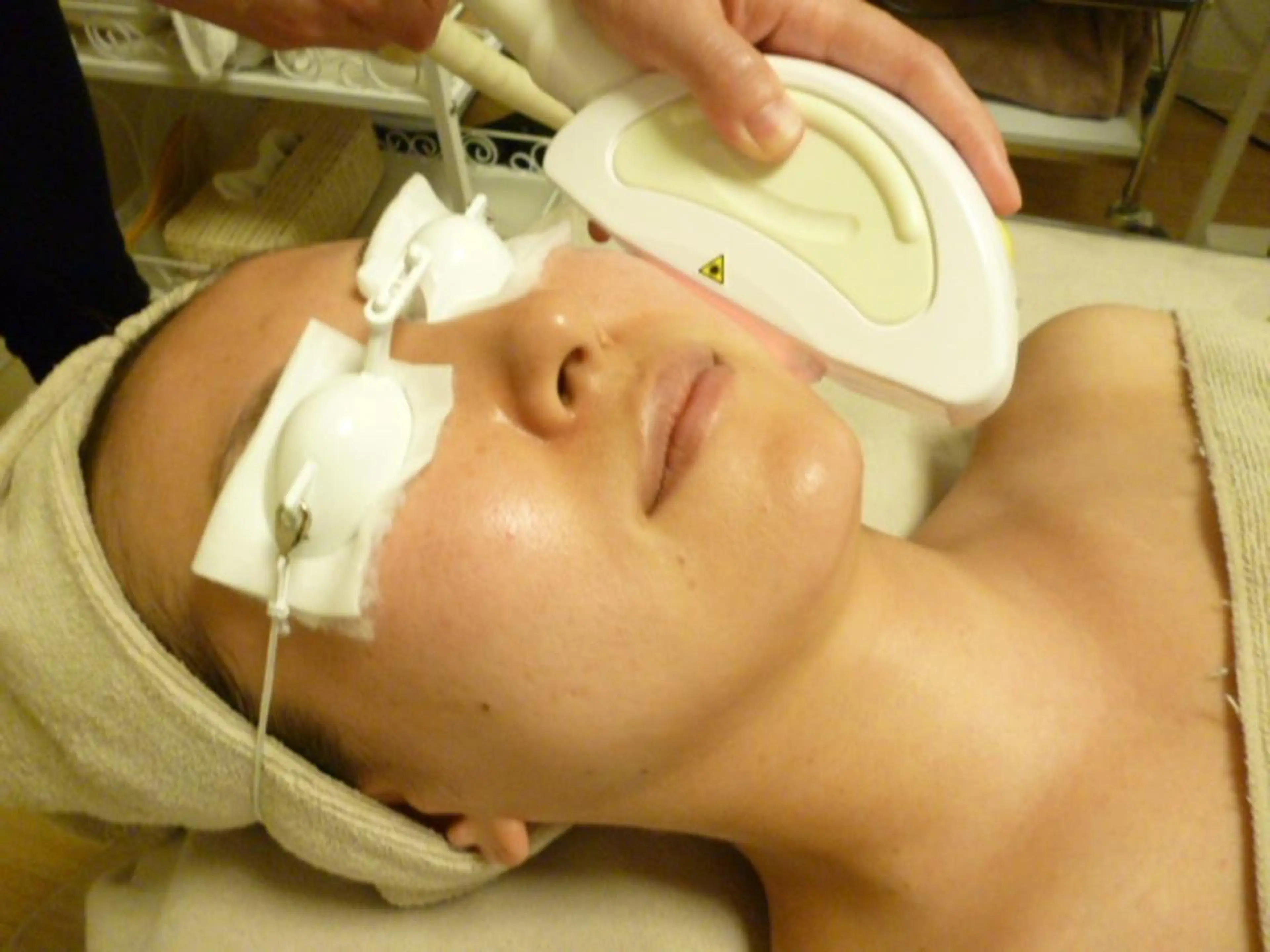 ☆新規様限定☆光シャワーフェイシャル70分シワ、しみ、たるみ、赤ら顔でお悩みの方に！の写真