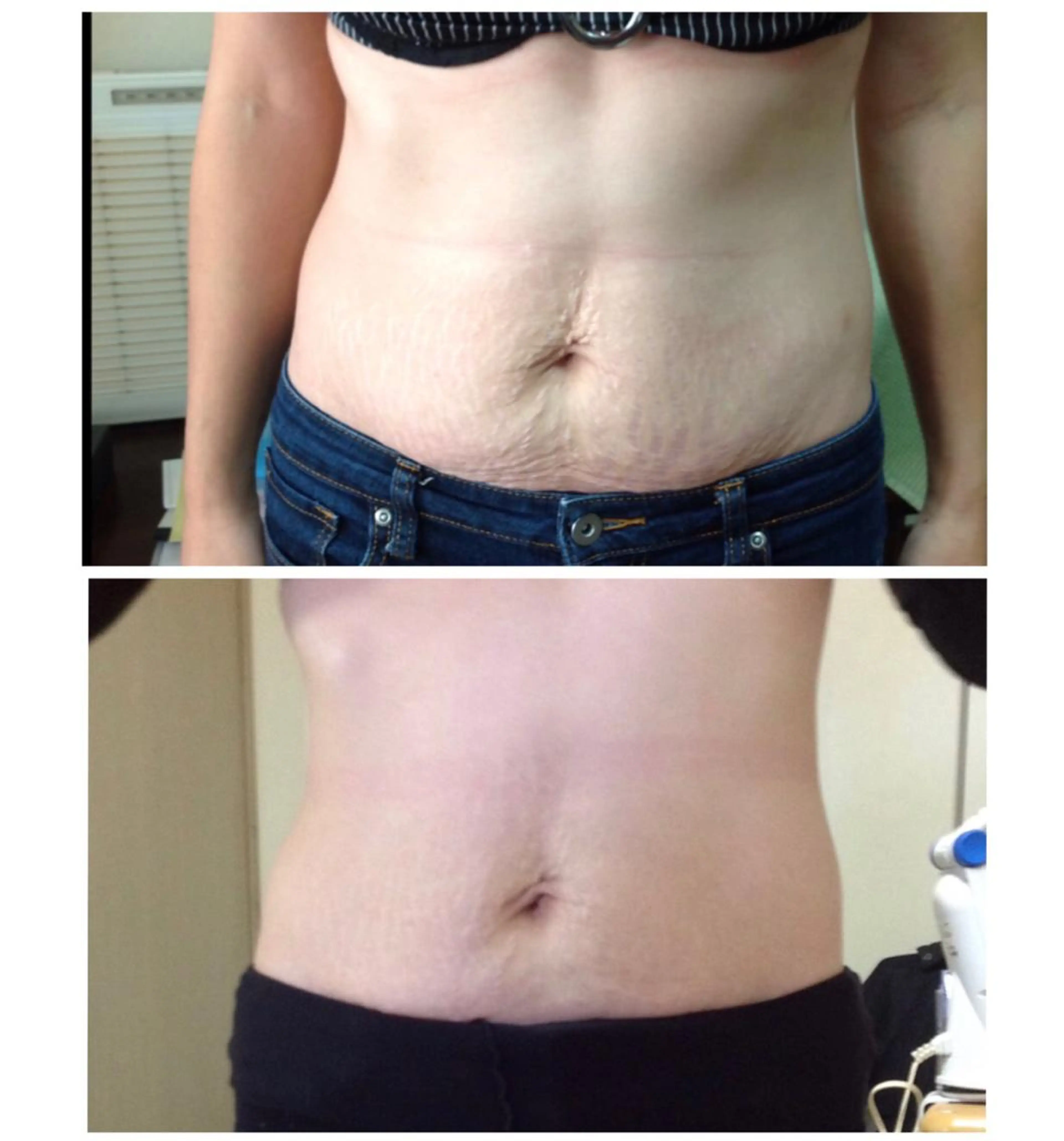 ビューティーホリック 東金店のエステ・リラクイメージ