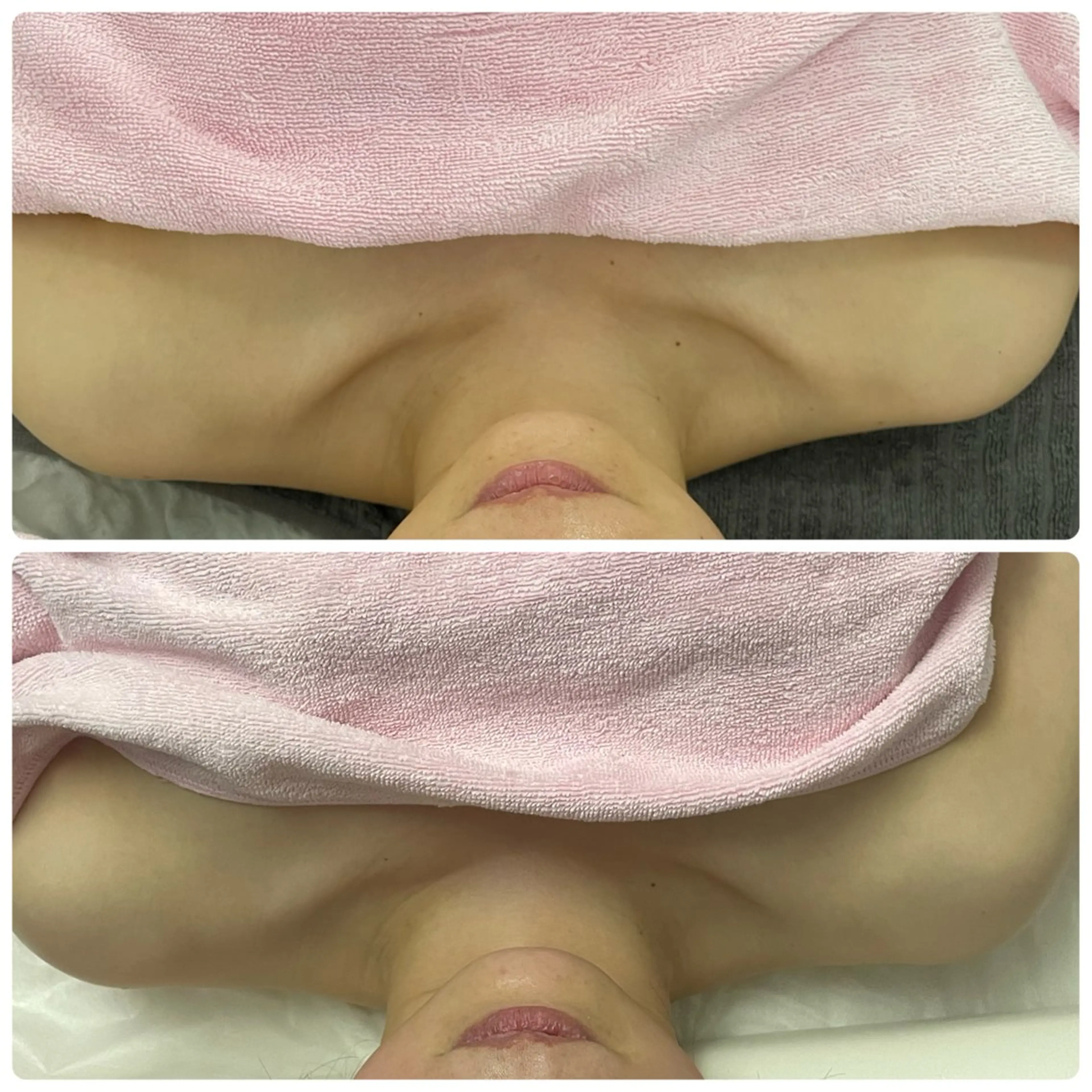 Salon Rion所属・Rion 野々村のエステ・リラクイメージ