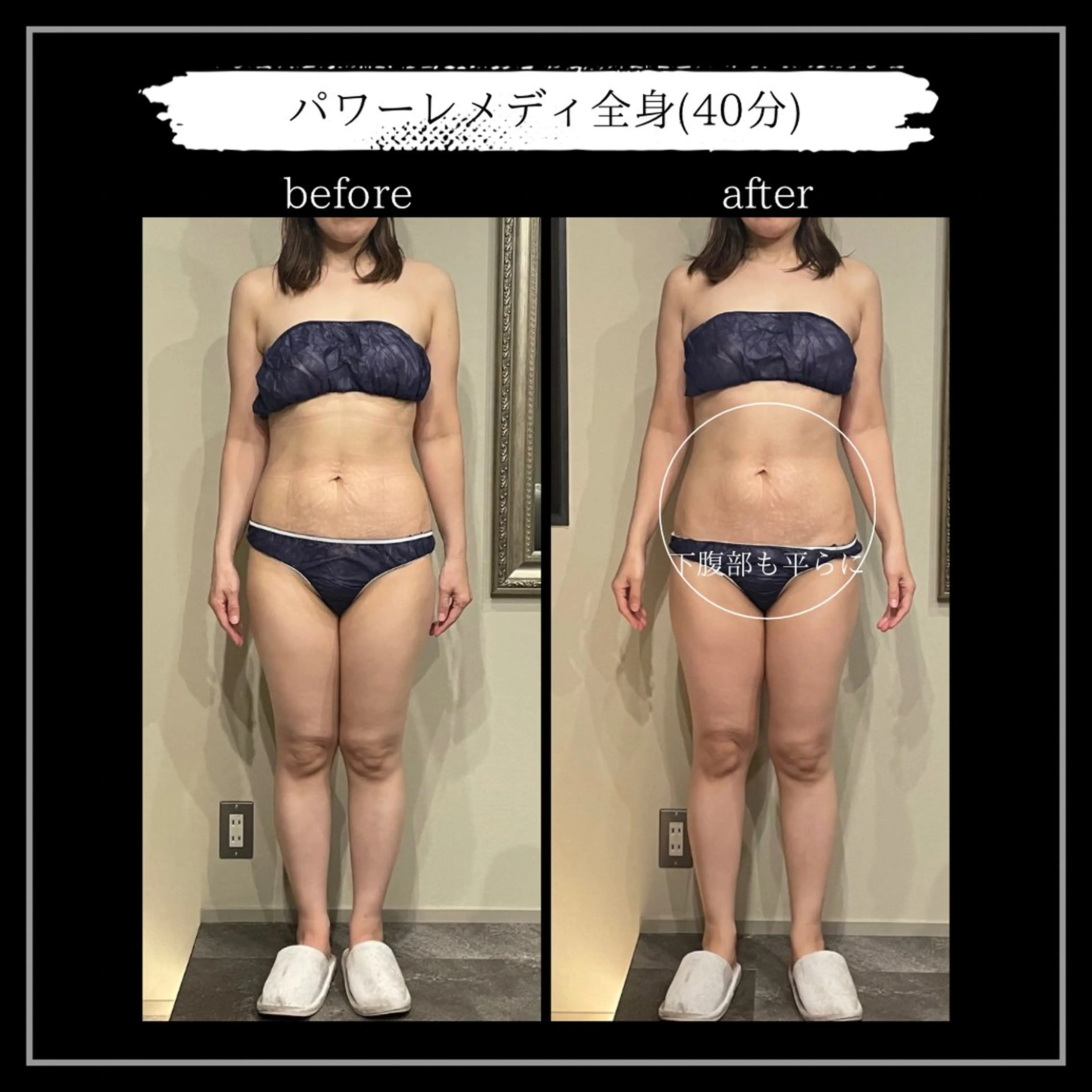 オフ:オン所属・オフ:オン 全身筋膜マッサージのエステ・リラクイメージ