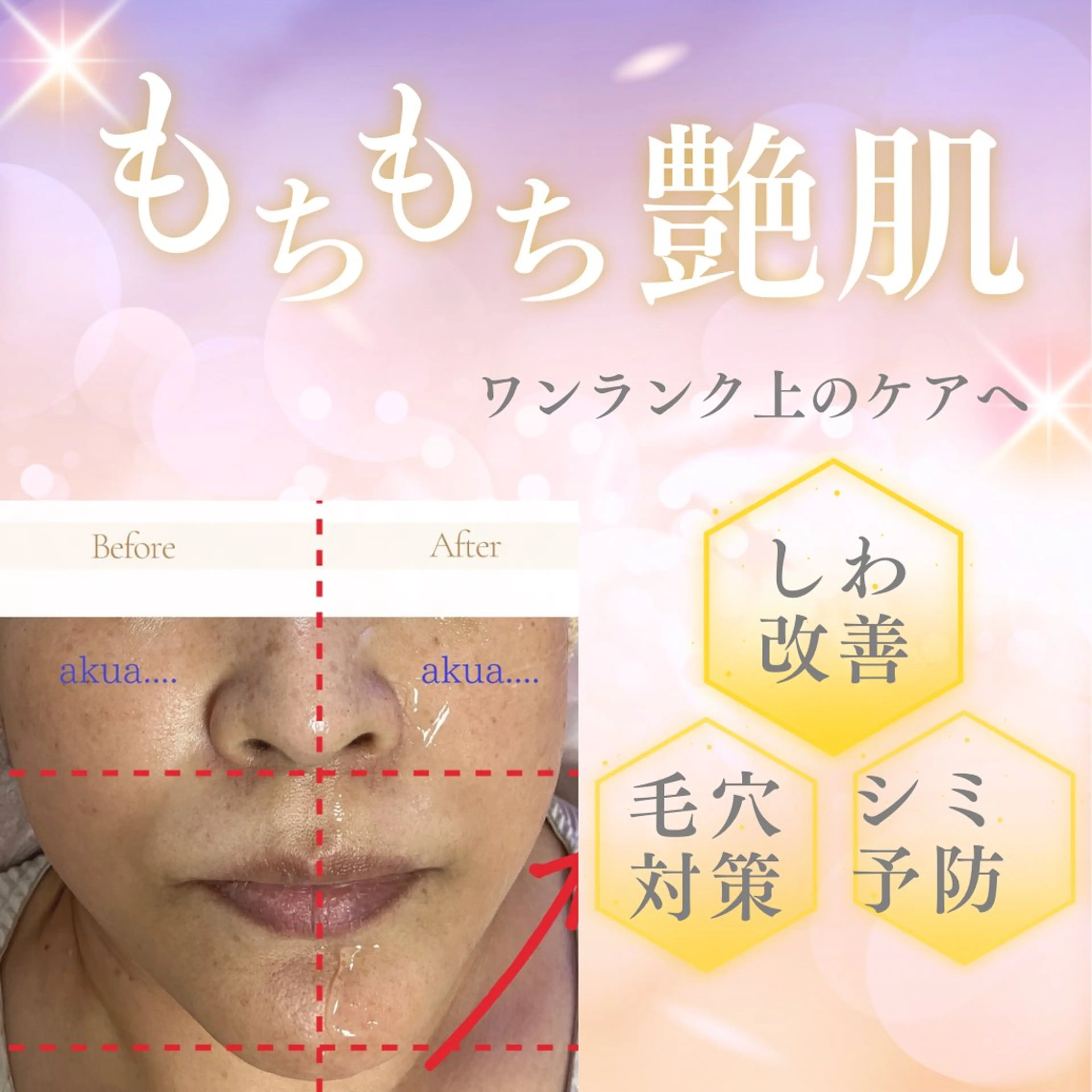 その他 akua... 【肌質管理専門】のその他イメージ