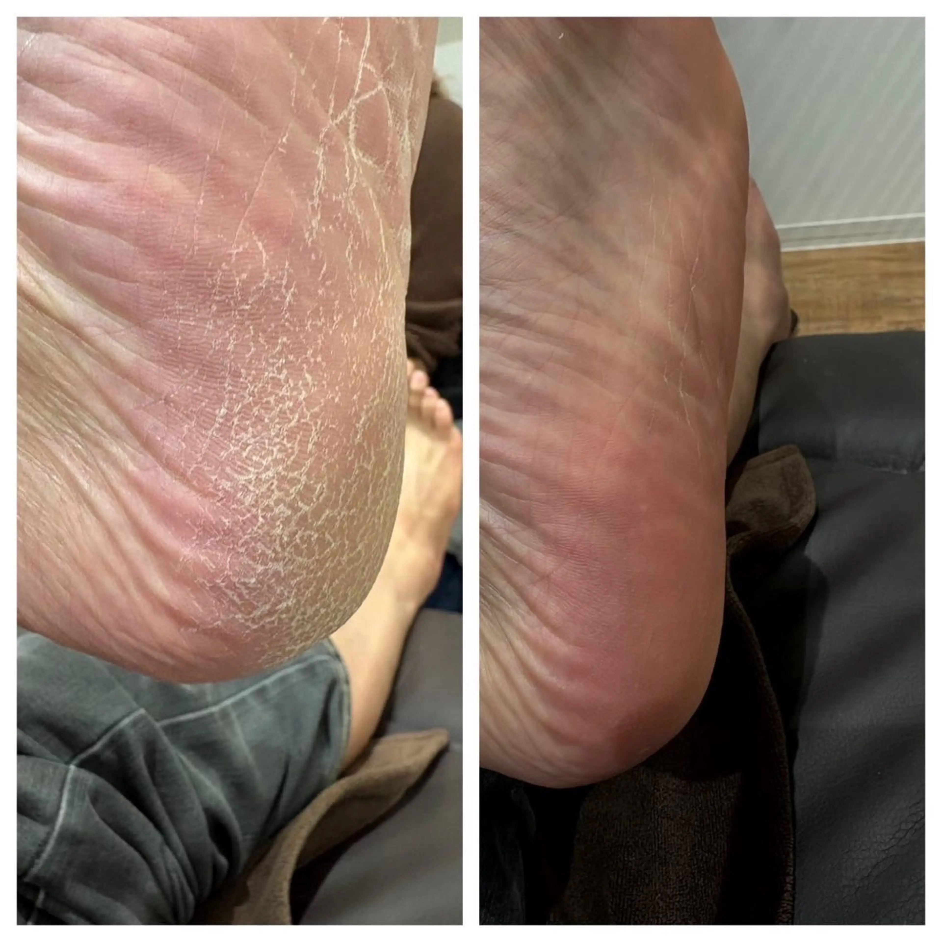 ネイル その他(ネイル) hair&make EARTH coiffure beaute 龍ケ崎店所属・神嵜 明日香のネイルデザイン