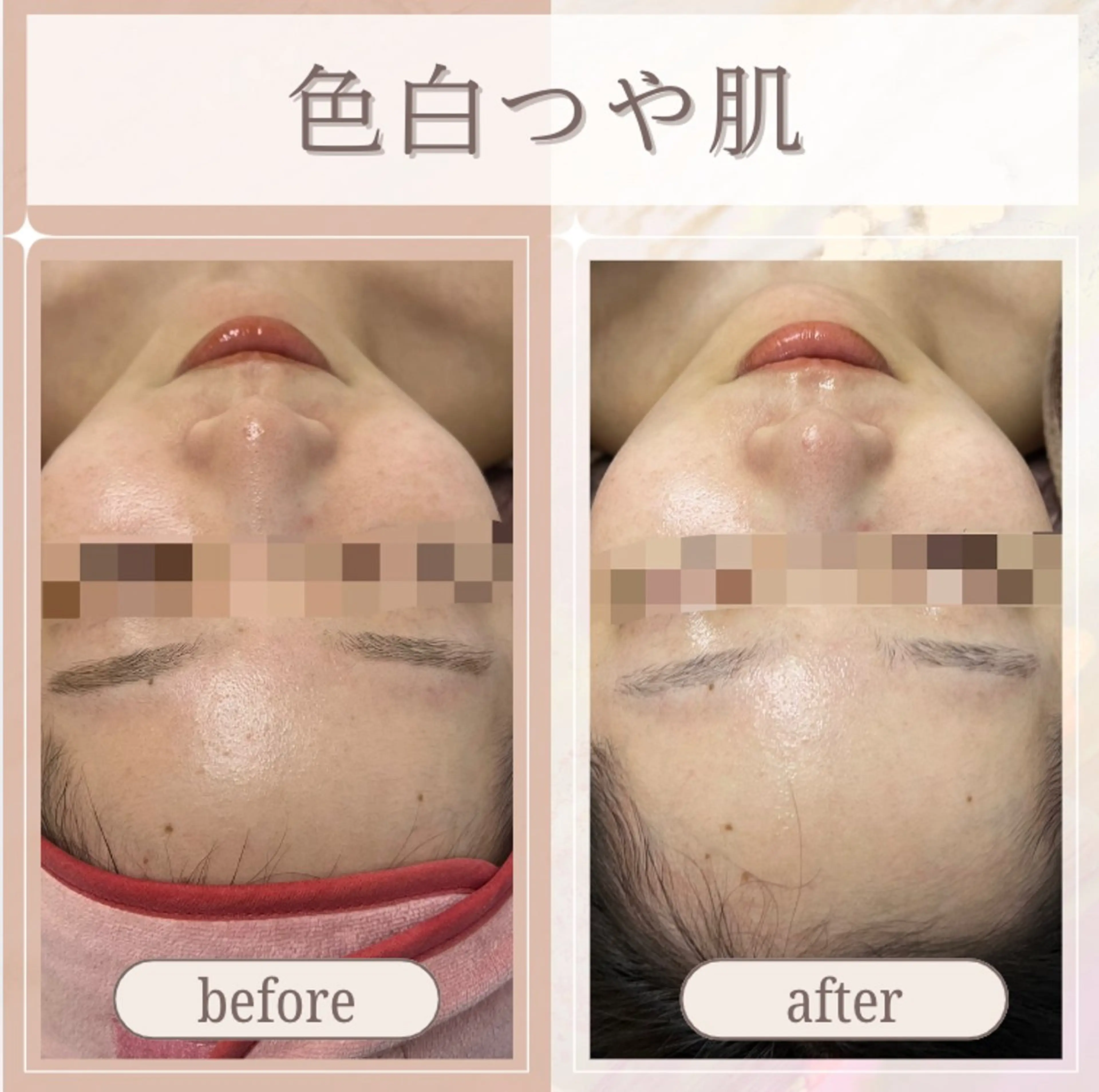 🎀韓国式肌改善🎀 Miku🇰🇷💎のその他イメージ