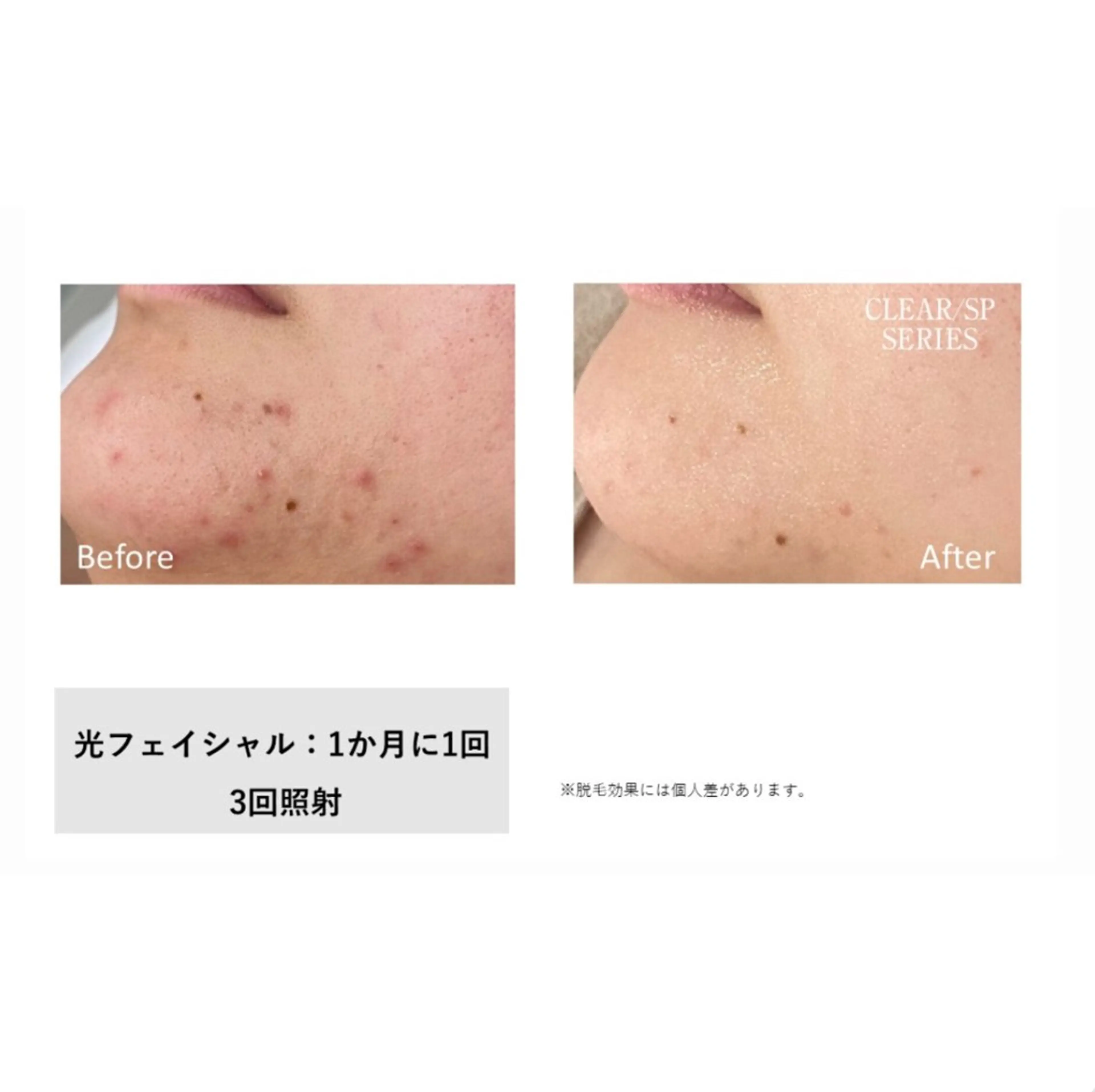 【痩身・脱毛】private salon Eclat所属・伊藤 心のエステ・リラクイメージ