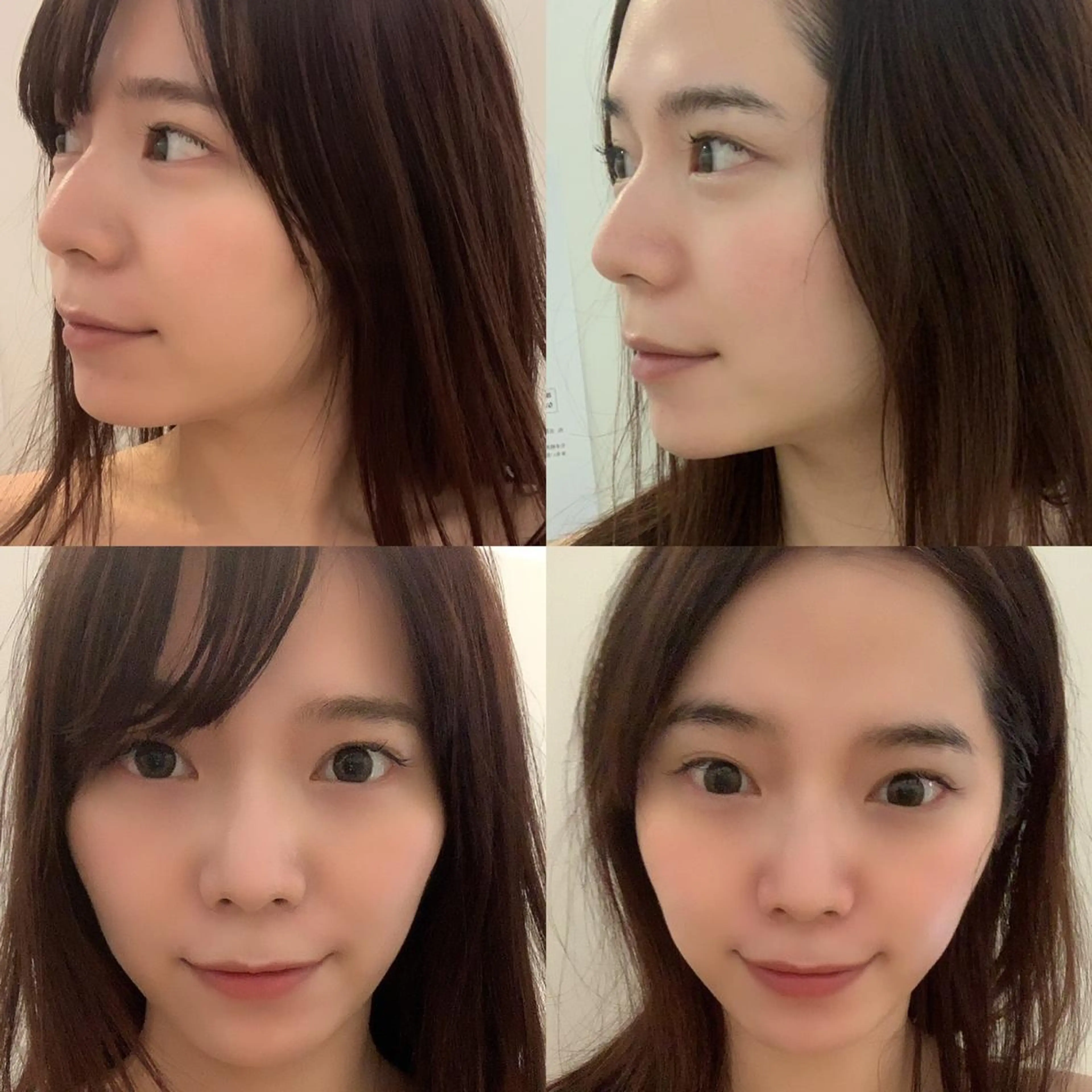 エステ 毛穴/ピーリング ララピール/POLAのエステ・リラクイメージ