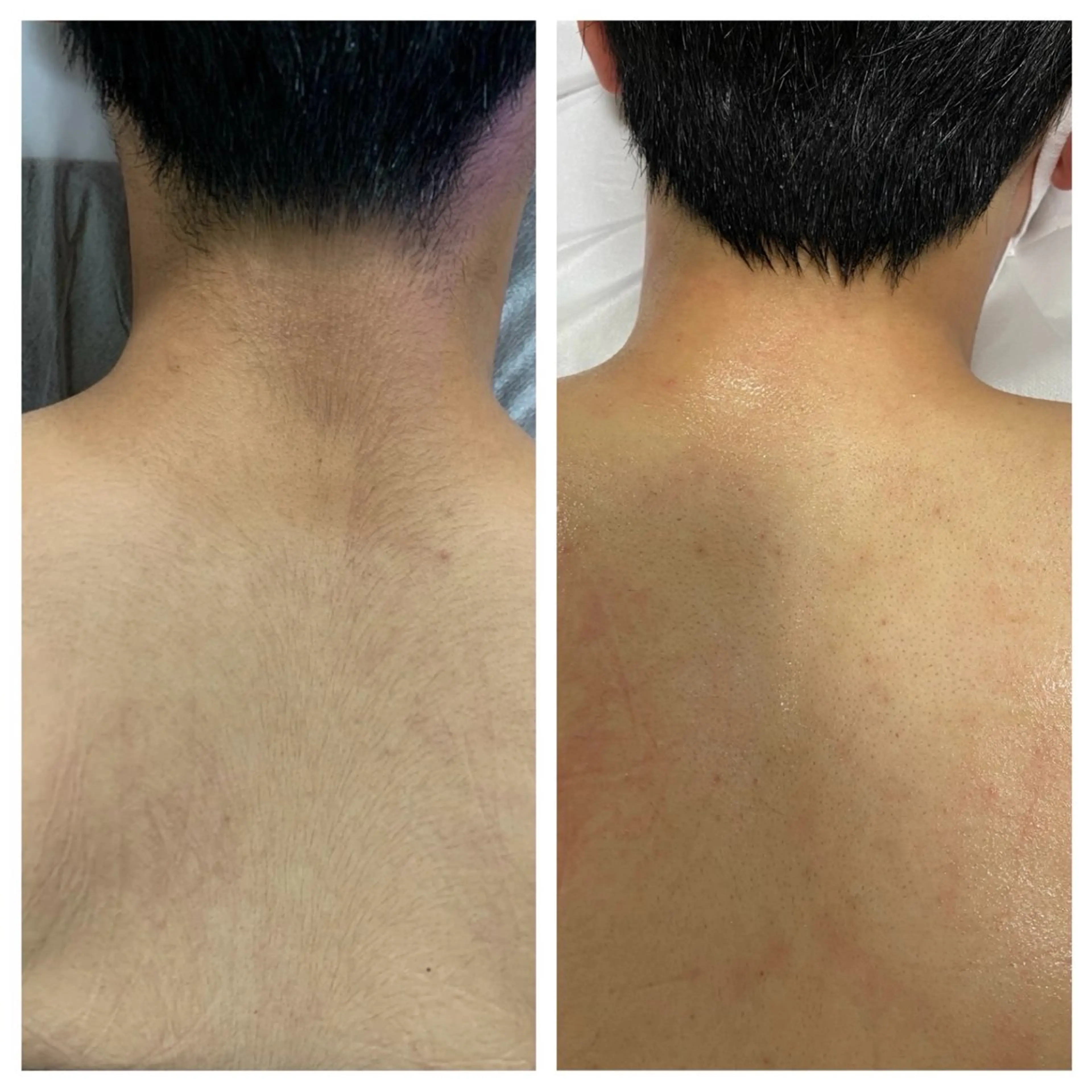 メンズ 脱毛 Lumus Solarum所属・Lumus Solarumのエステ・リラクイメージ